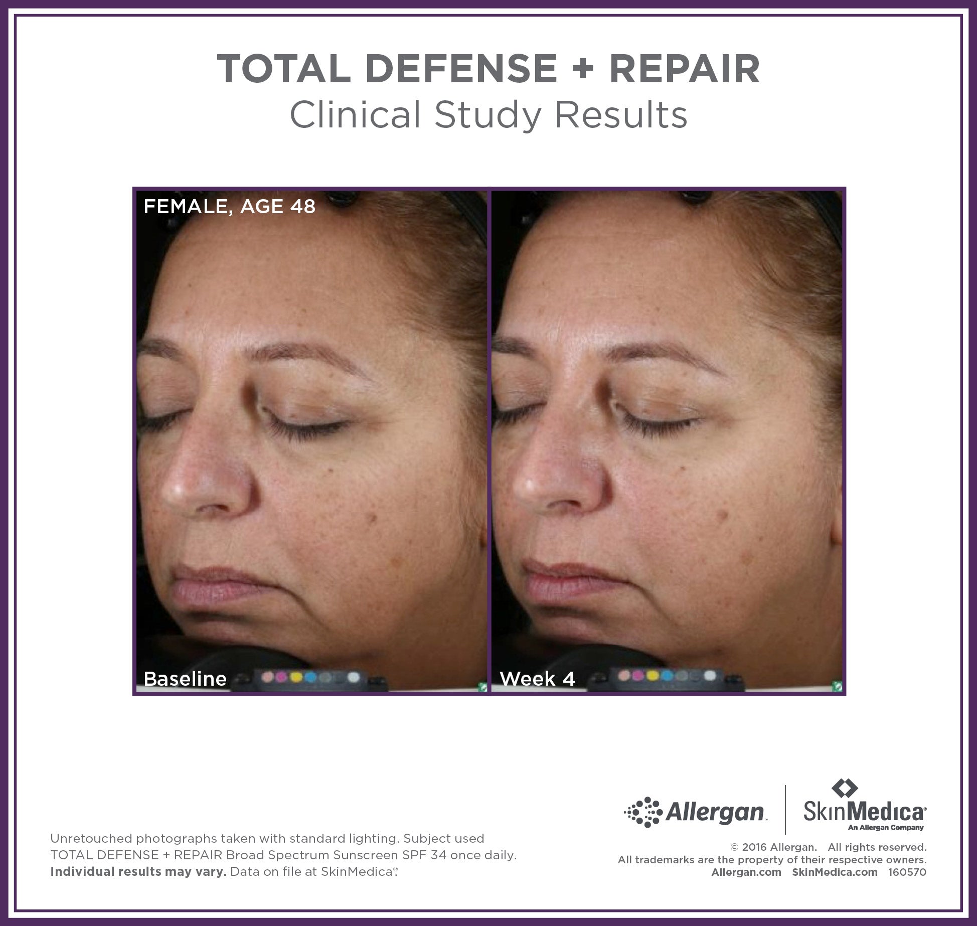 <transcy>SkinMedica Total Defense + Repair Broad Spectrum SPF 34 / PA++++ 防曬霜(2.3 盎司)</transcy>