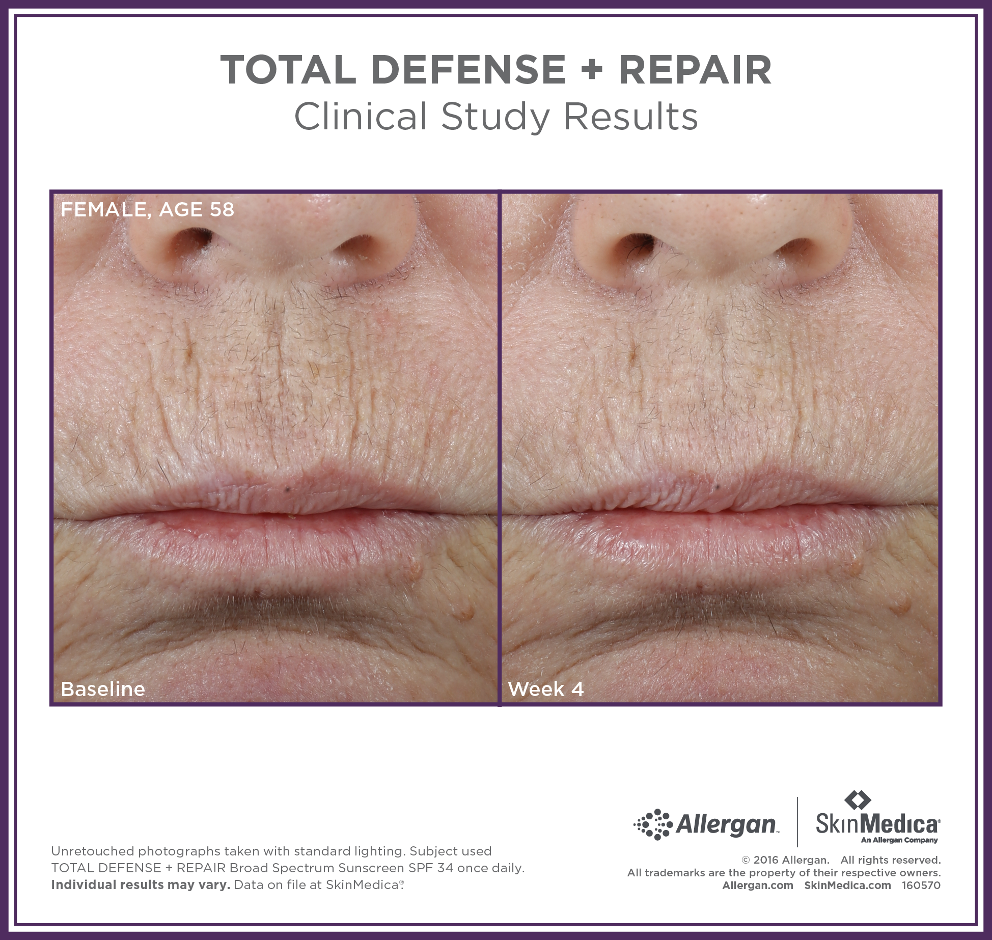 <transcy>SkinMedica Total Defense + Repair 廣譜防曬霜 SPF 34 有色(2.3 盎司)</transcy>