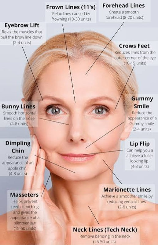 Botox