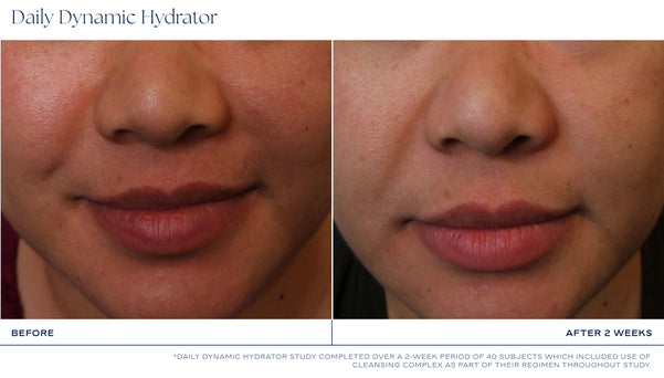 iS Clinical Daily Dynamic Hydrator (1.7 oz)