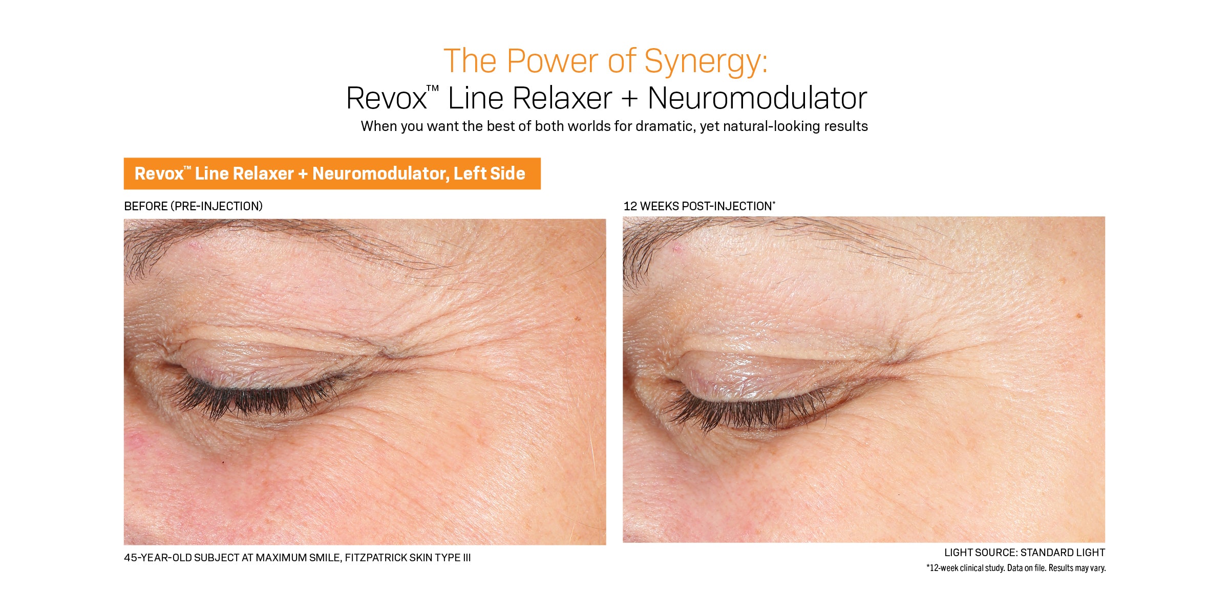 Revision Skincare Revox™ Line Relaxer (0.68 oz)