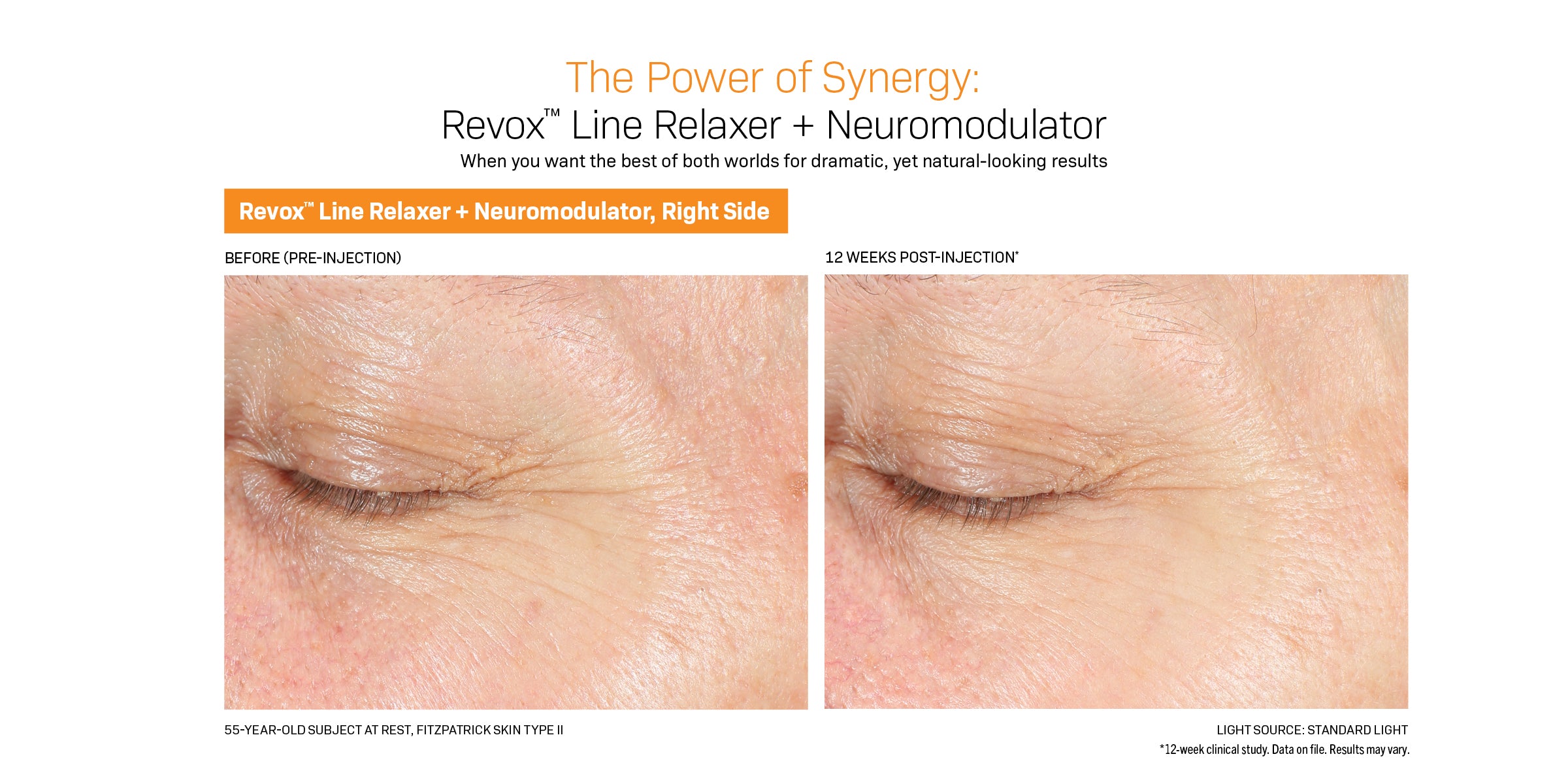 Revision Skincare Revox™ Line Relaxer (1 oz)