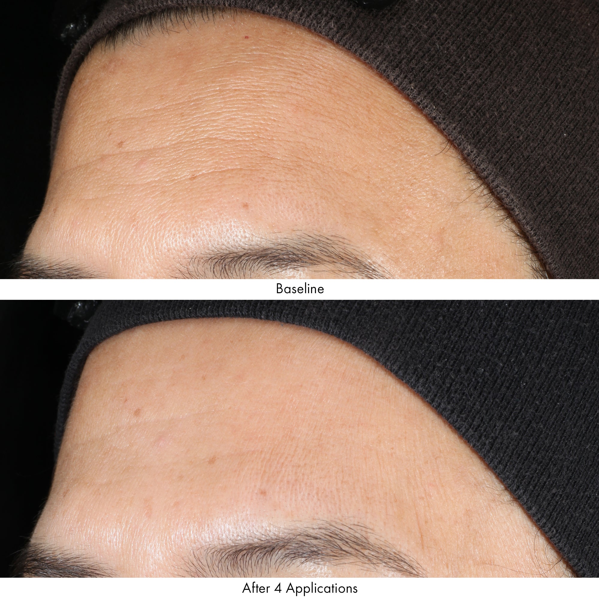 Obagi Revivify Multi-Acid Facial Peel