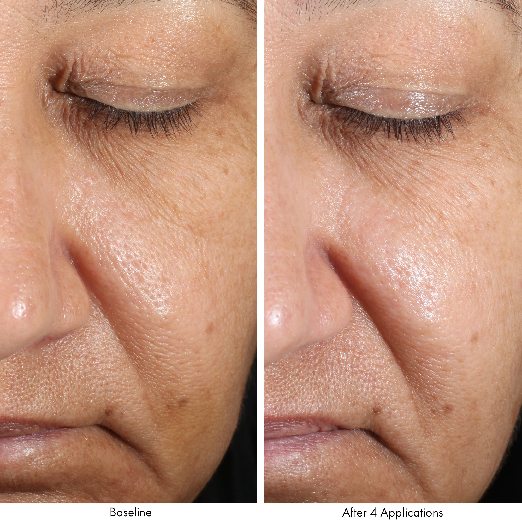 Obagi Revivify Multi-Acid Facial Peel