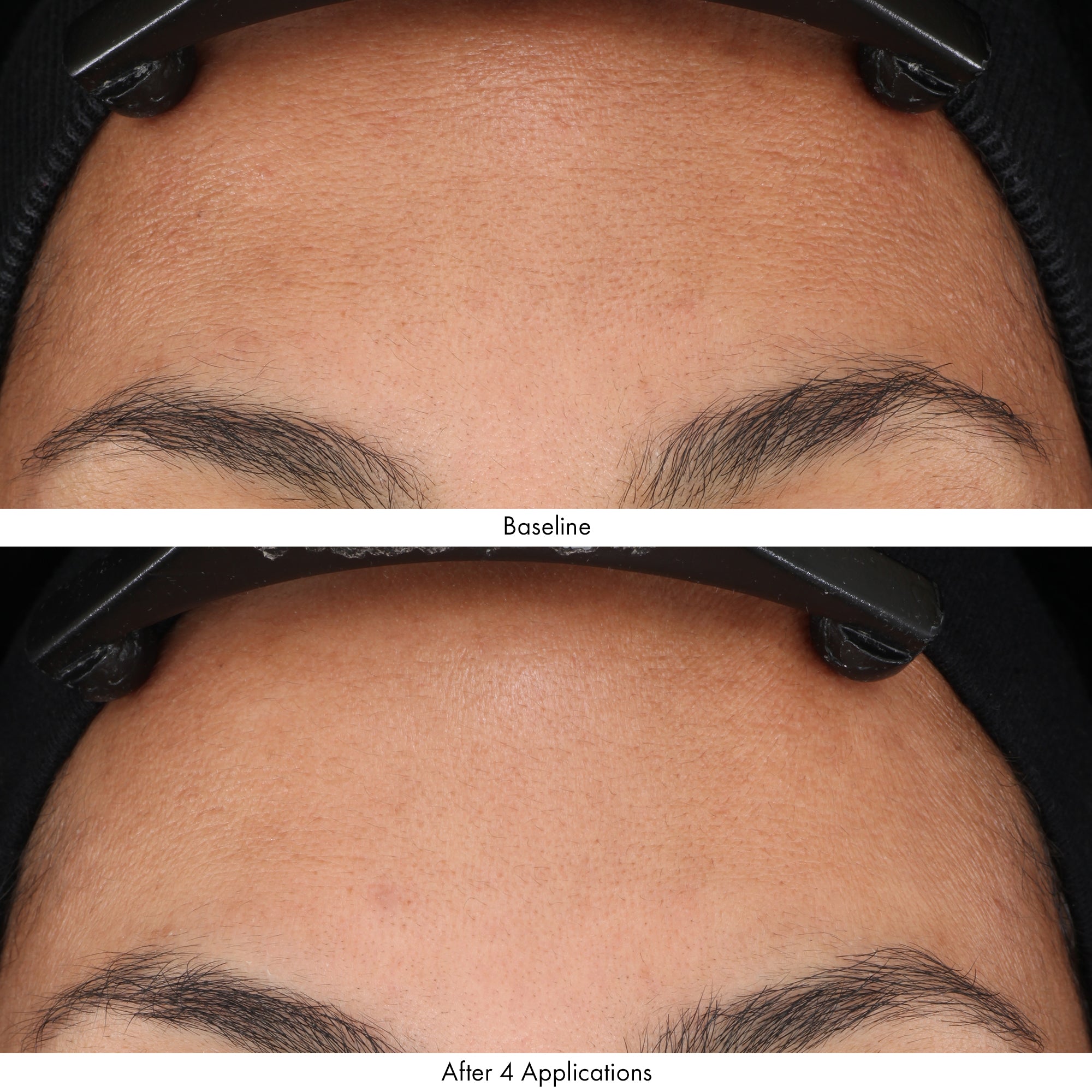 Obagi Revivify Multi-Acid Facial Peel