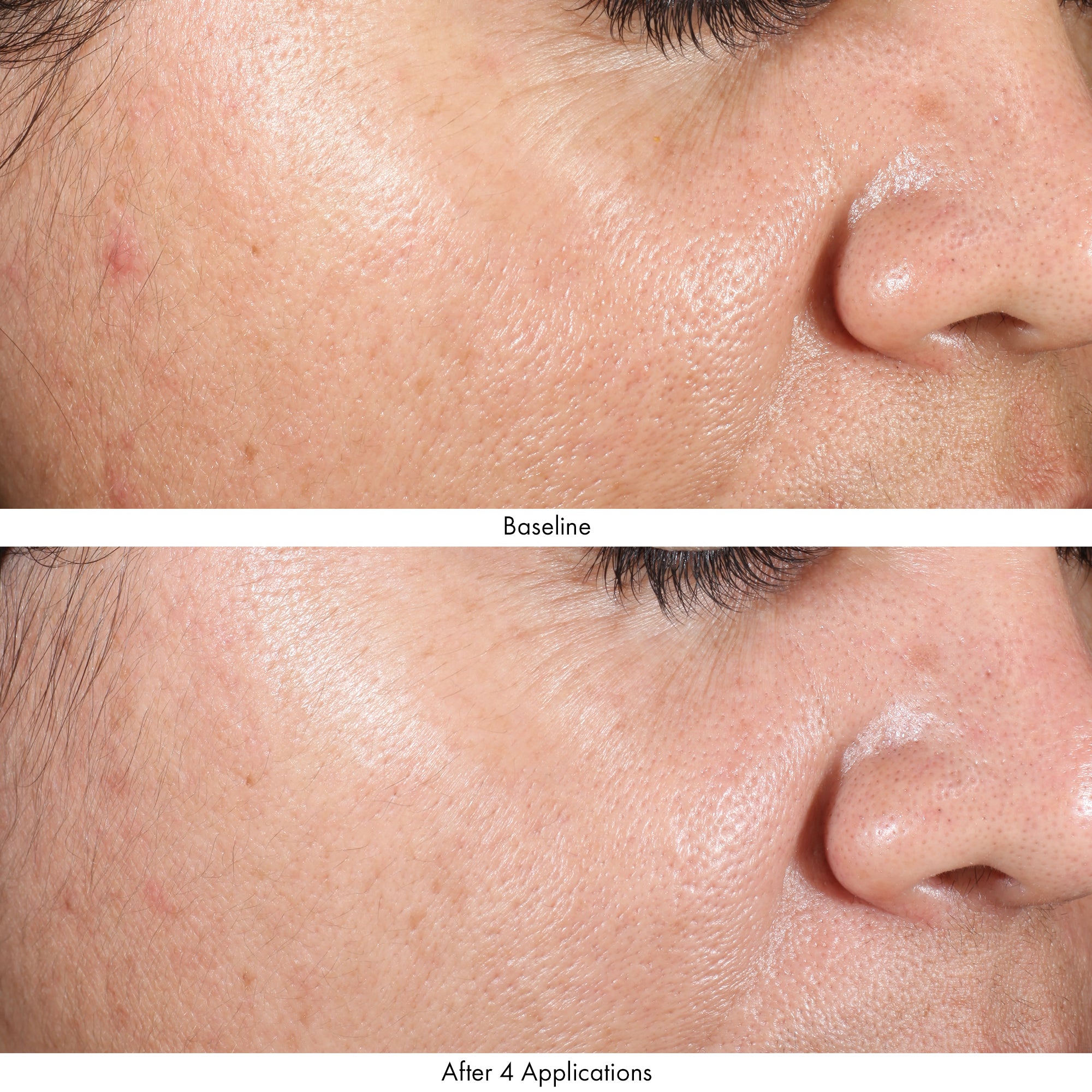 Obagi Revivify Multi-Acid Facial Peel