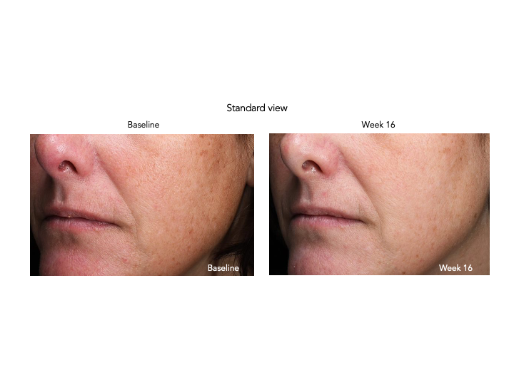 Senté Pigment & Tone Correcting Mask Cysteamine HSA (1.69 oz)