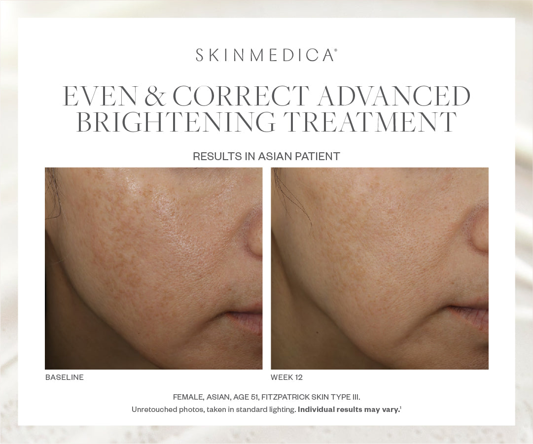 SkinMedica Even & Correct Advanced Lightening Serum (2 унції)