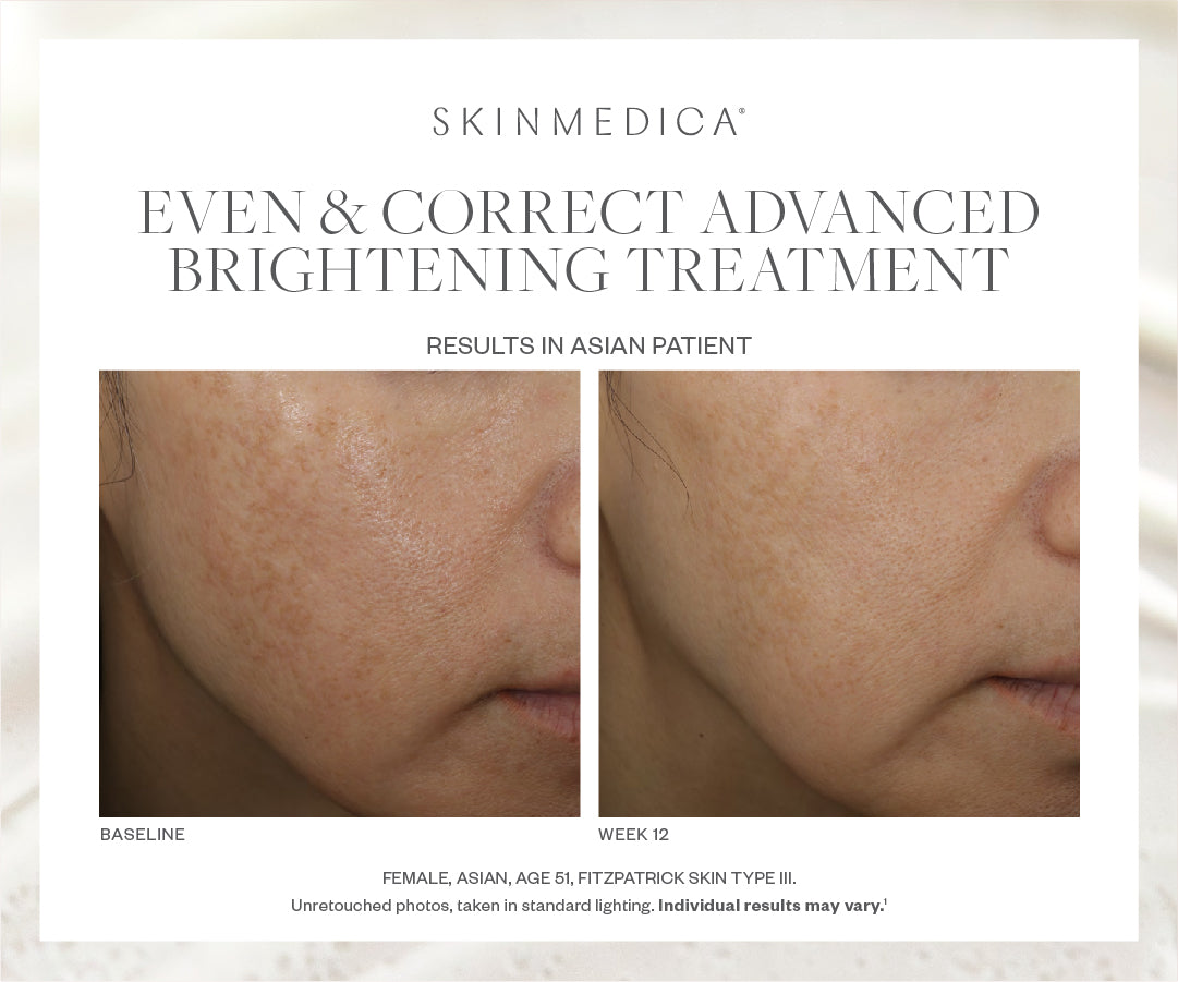SkinMedica Even & Correct Advanced Brightening Serum (2 oz)