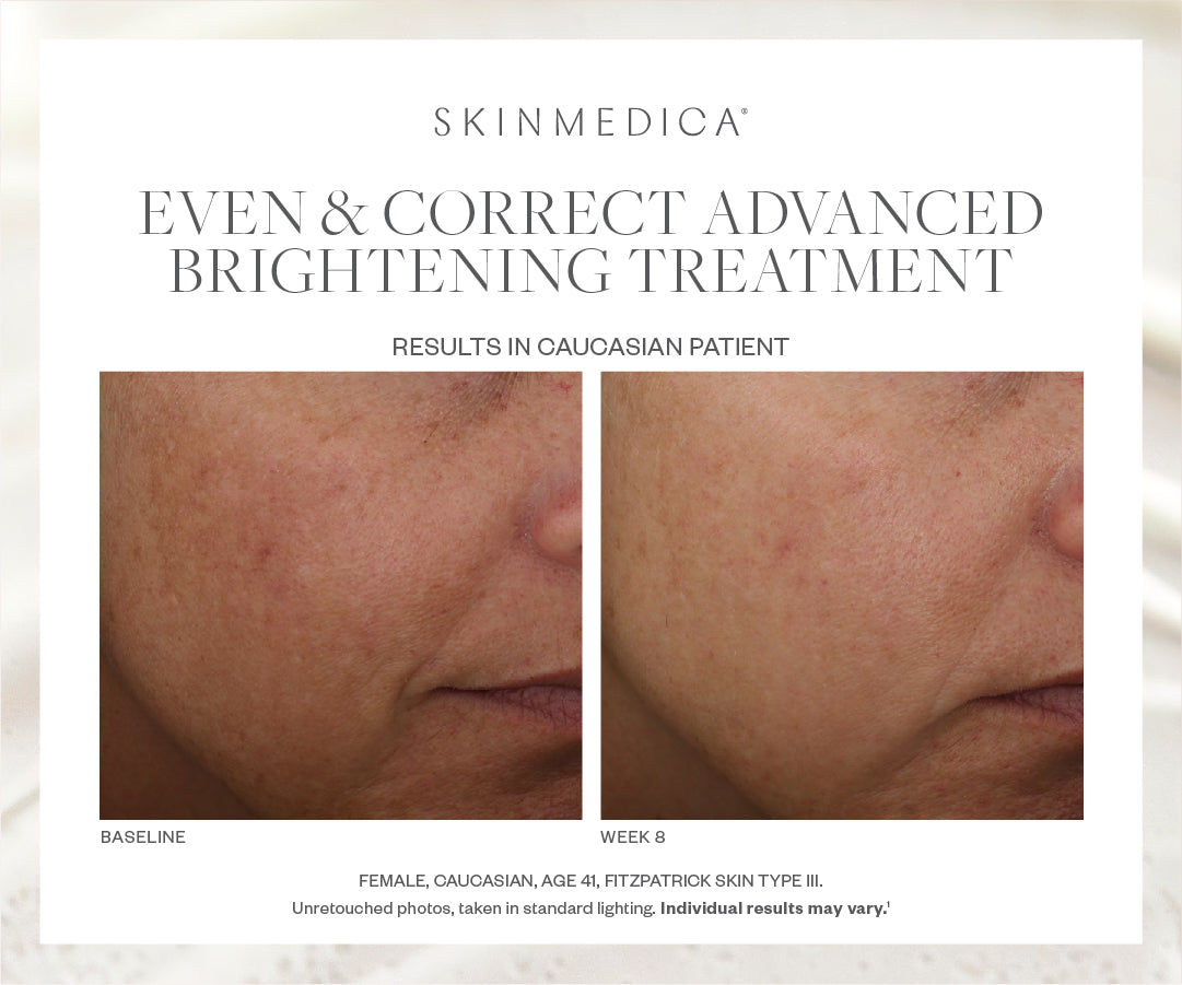 SkinMedica Even & Correct Advanced Brightening Serum (2 oz)