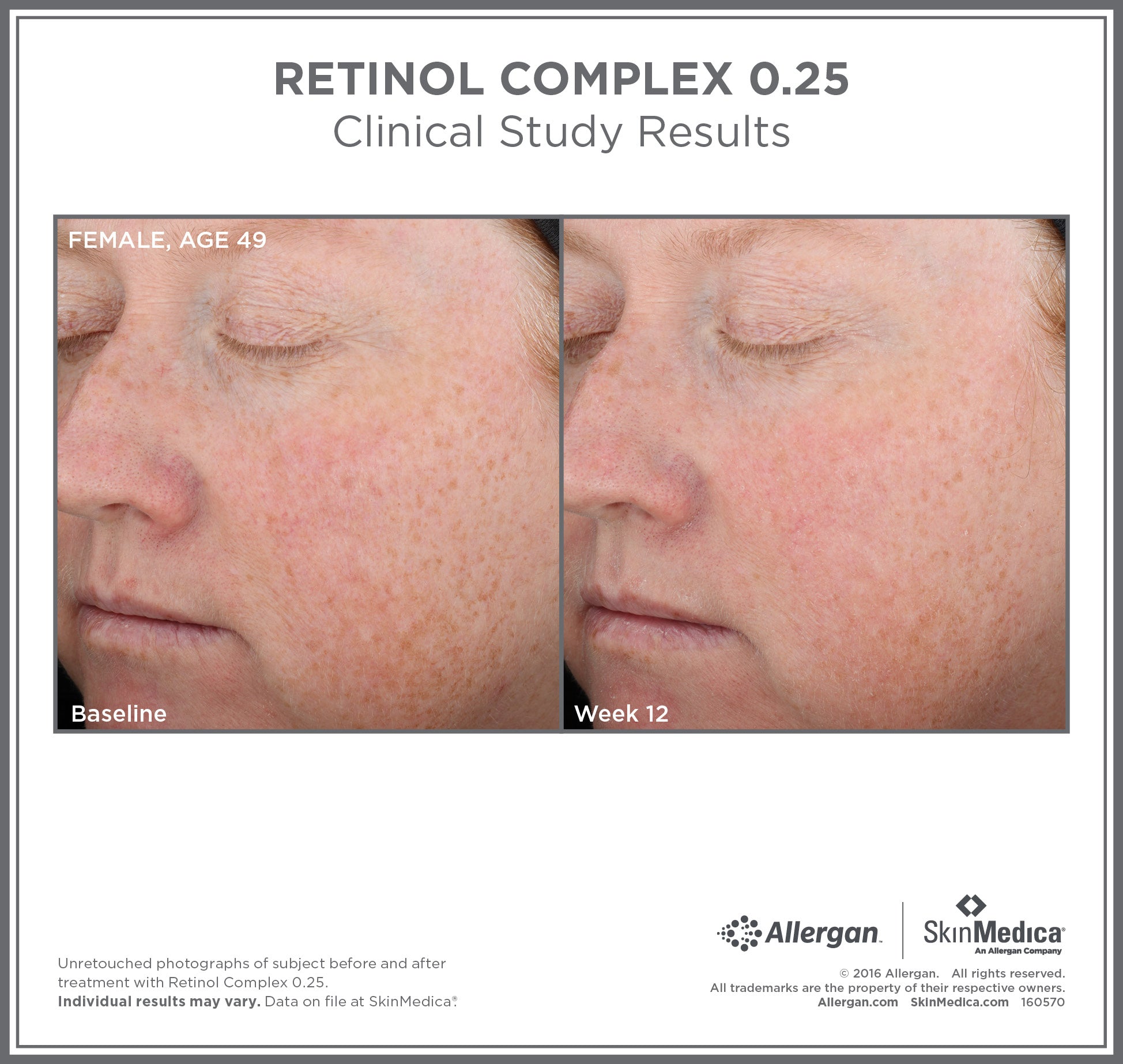 SkinMedica Retinol Complex 0.25 (1 oz)