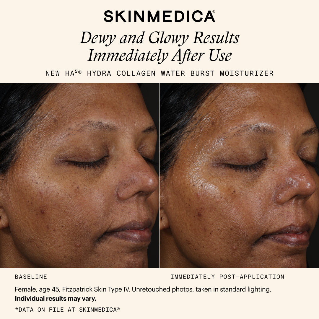 SkinMedica HA5 Hydra Collagen Water Burst Moisturizer (1.7 oz)