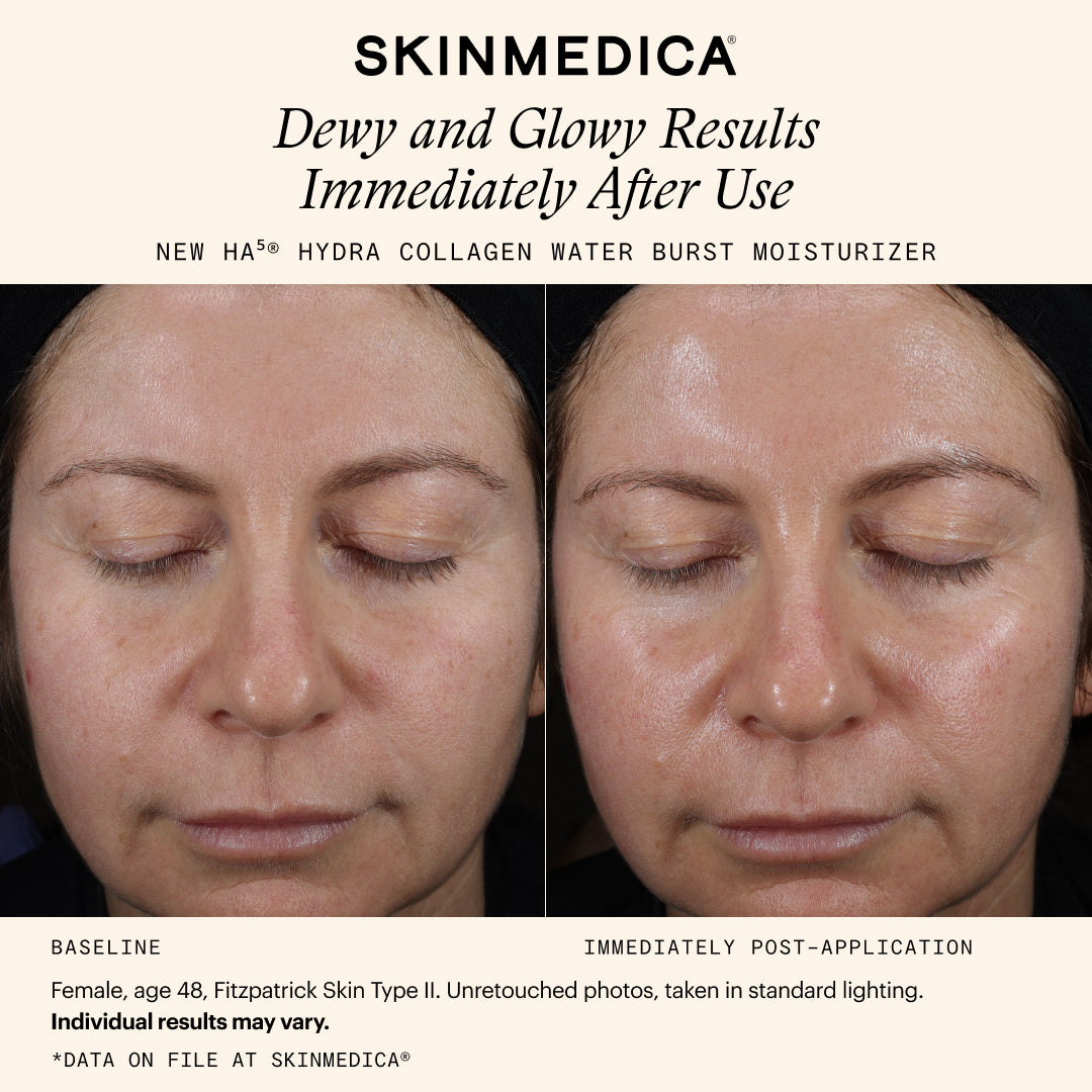 SkinMedica HA5 Hydra Collagen Water Burst Moisturizer (1.7 oz)