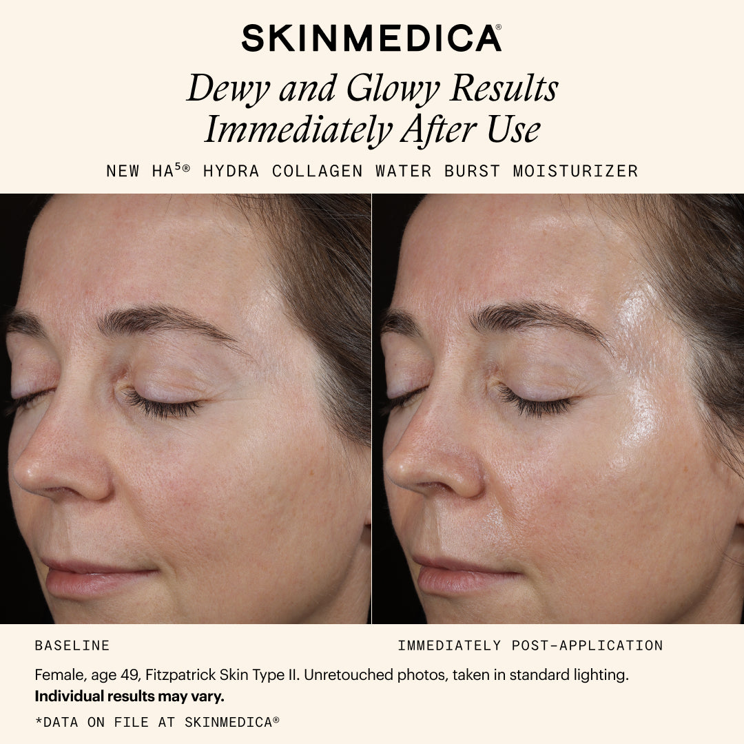 SkinMedica HA5 Hydra Collagen Water Burst Moisturizer (1.7 oz)