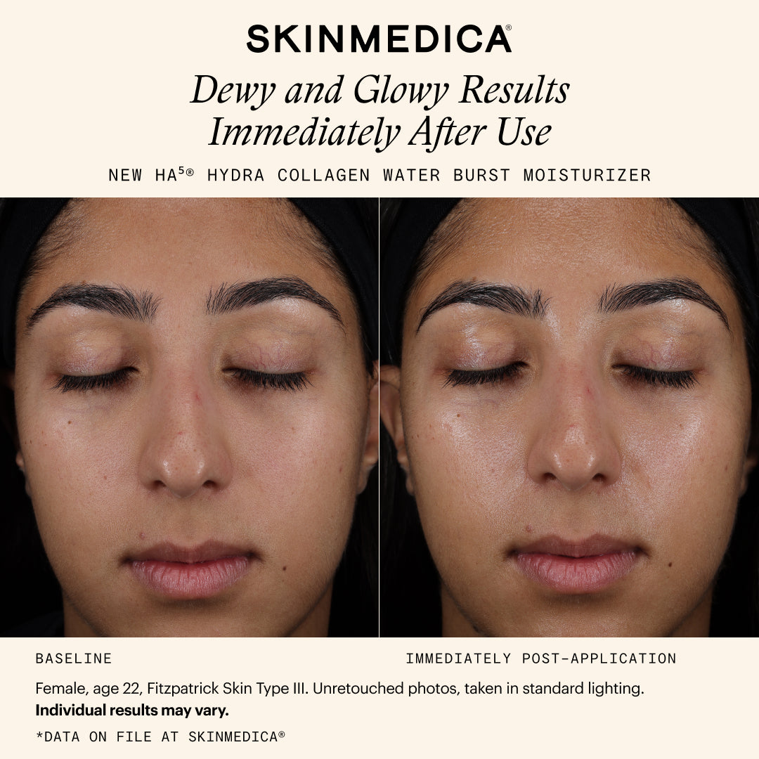 SkinMedica HA5 Hydra Collagen Water Burst Moisturizer (1.7 oz)