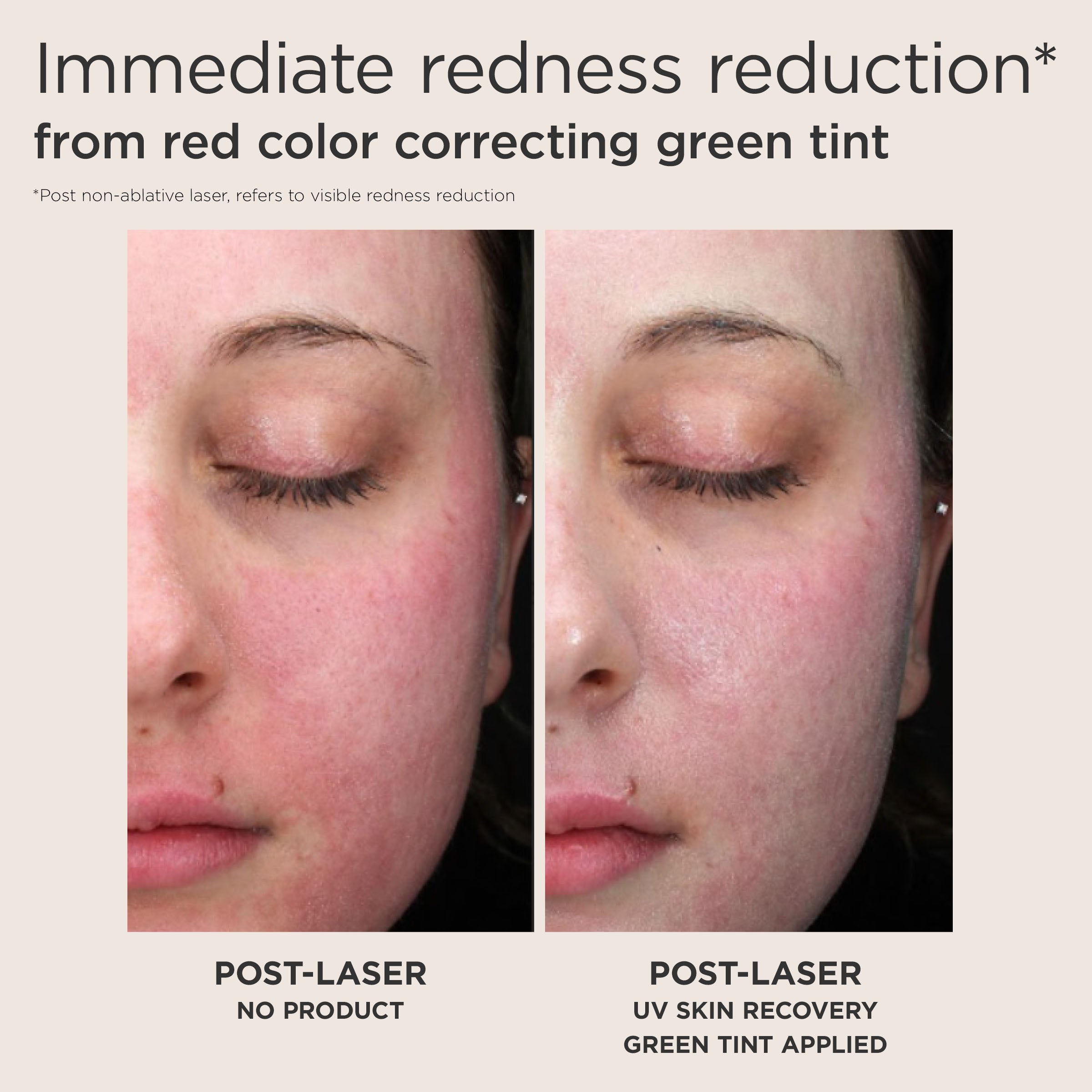 EltaMD UV Skin Recovery Red Color Correcting Green Tint Broad Spectrum SPF 50 (1.7 oz)