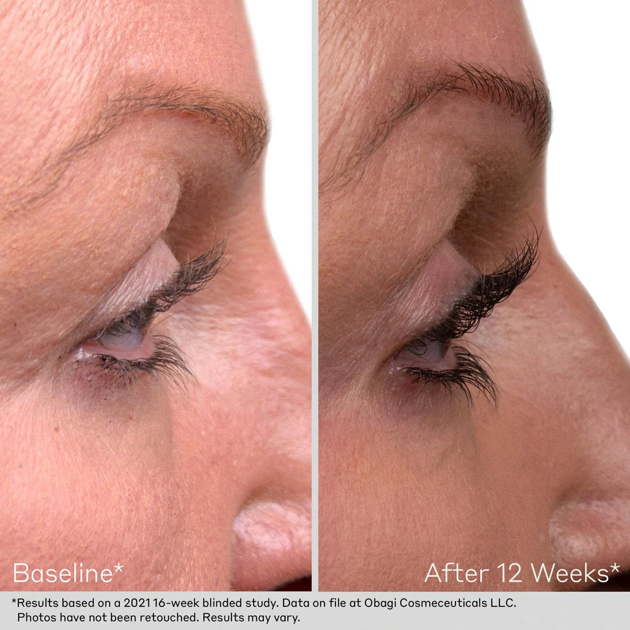 Obagi Nu-Cil Lash and Brow Serum Set.