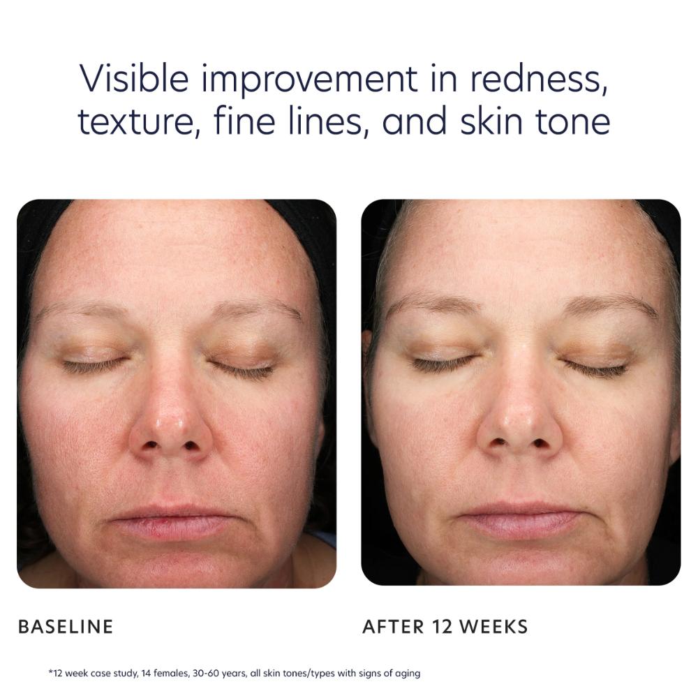 PCA Skin Triple Exfoliation Peel Pads