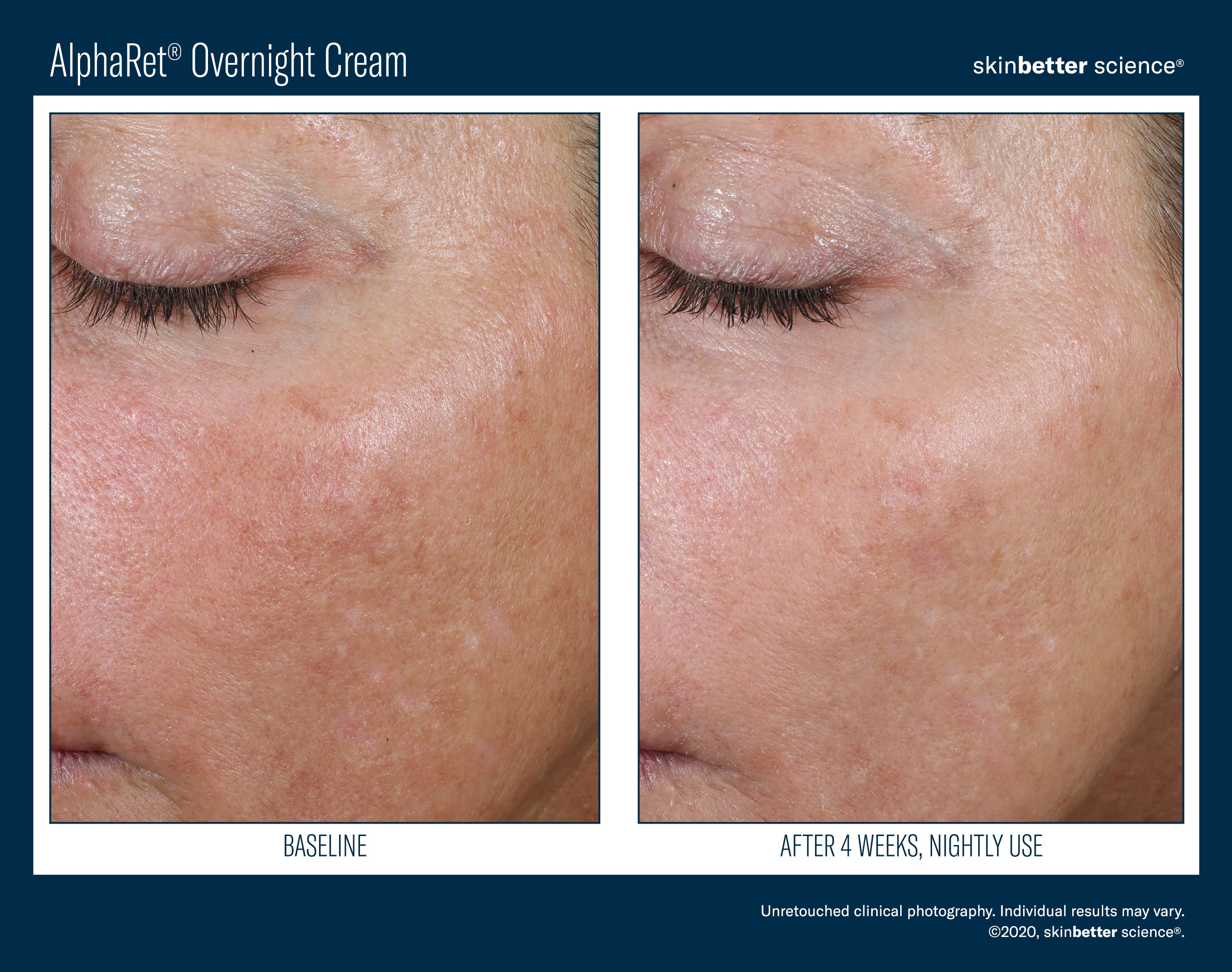 SkinBetter Science Trial Size AlphaRet Overnight Cream (0.17 oz)