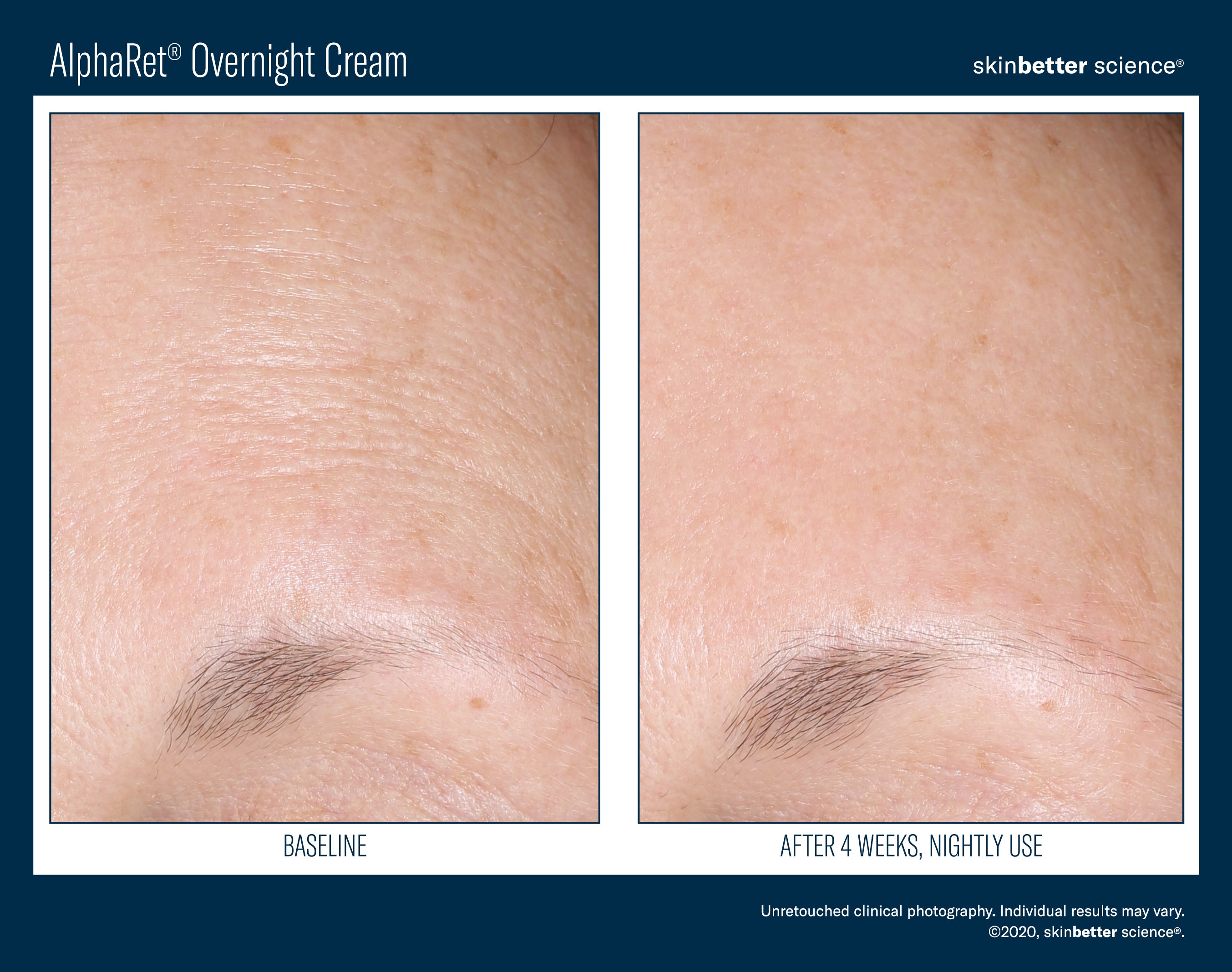 SkinBetter Science AlphaRet Overnight Cream (1.69 oz)