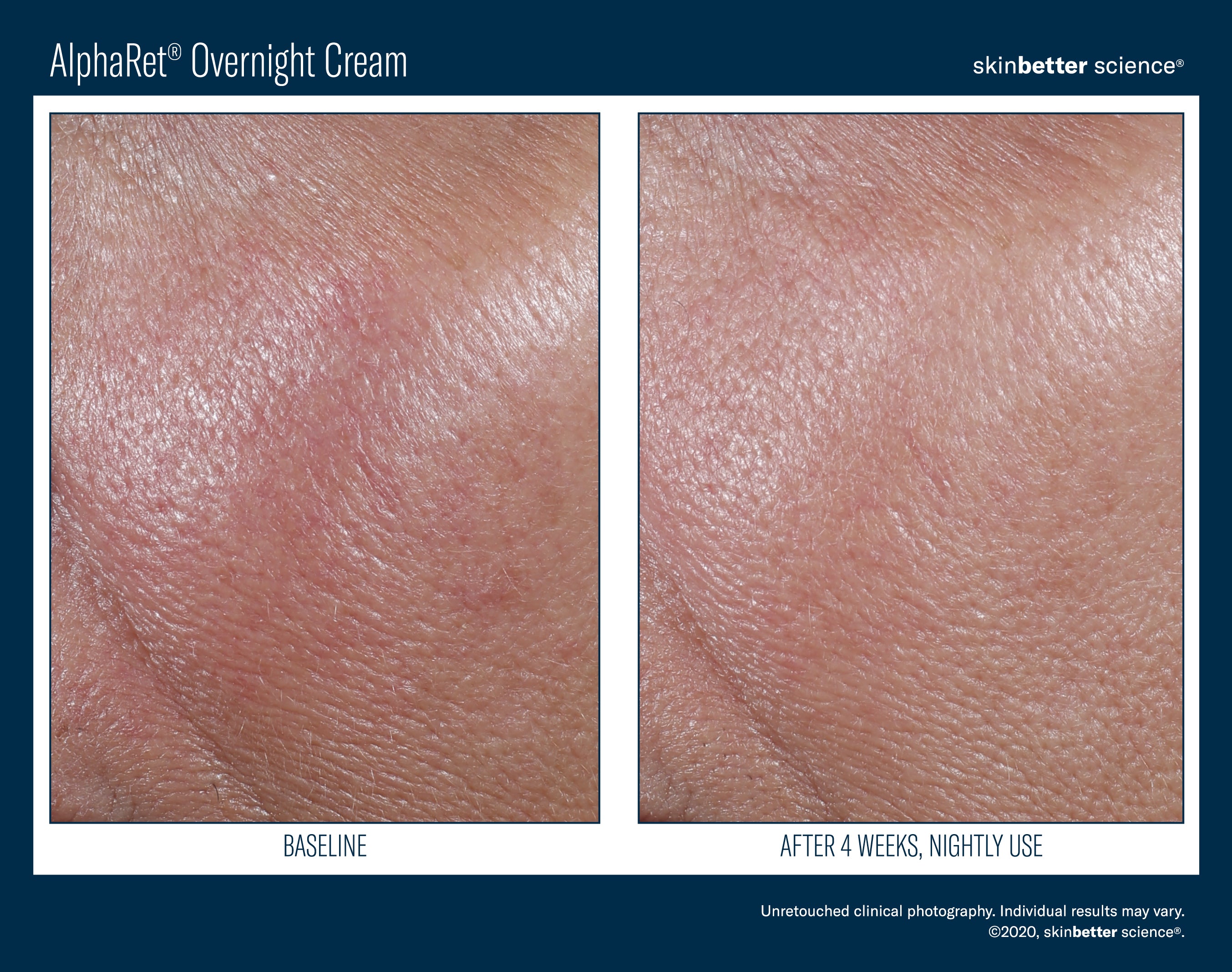 SkinBetter Science Trial Size AlphaRet Overnight Cream (0.17 oz)