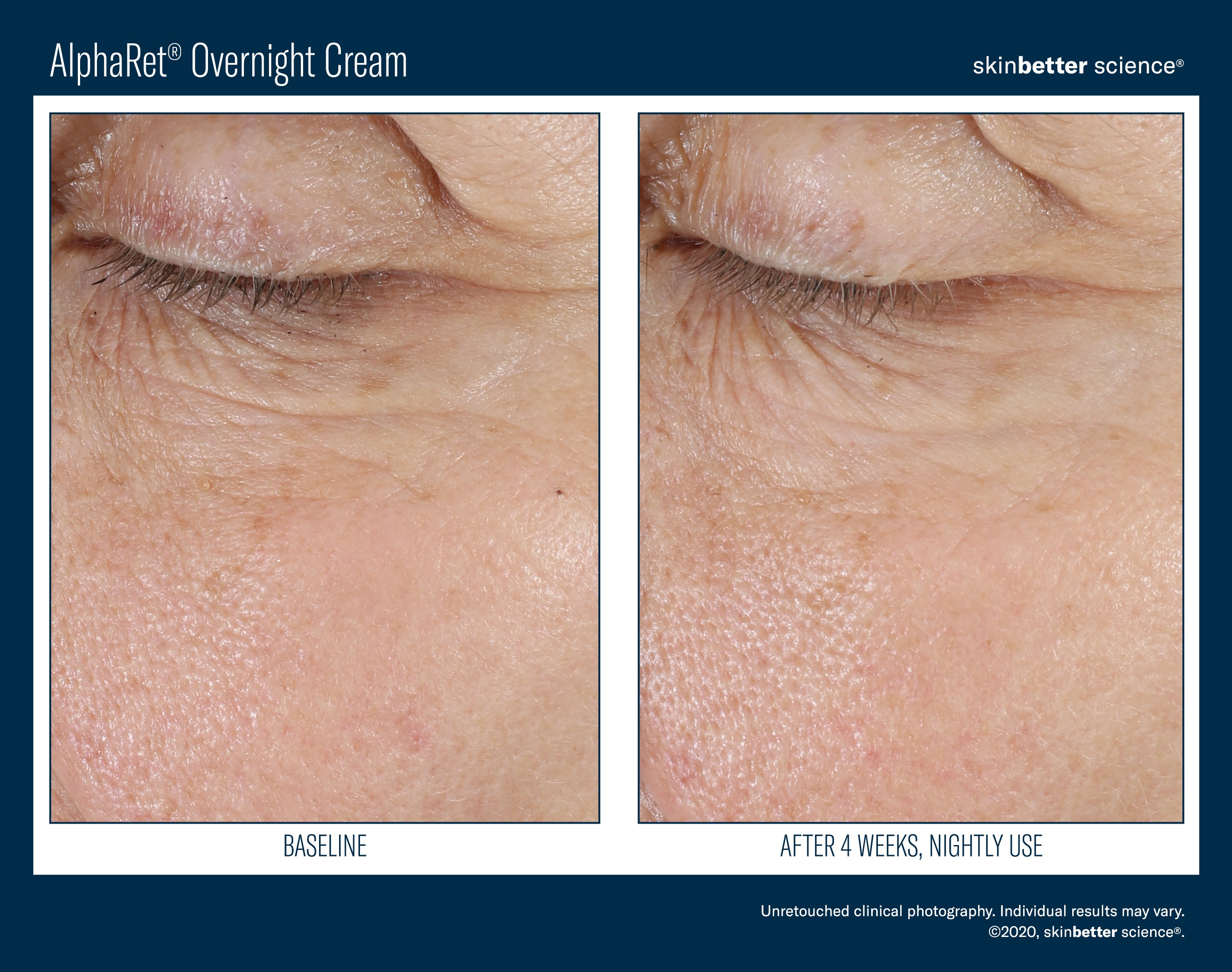 SkinBetter Science Trial Size AlphaRet Overnight Cream (0.17 oz)