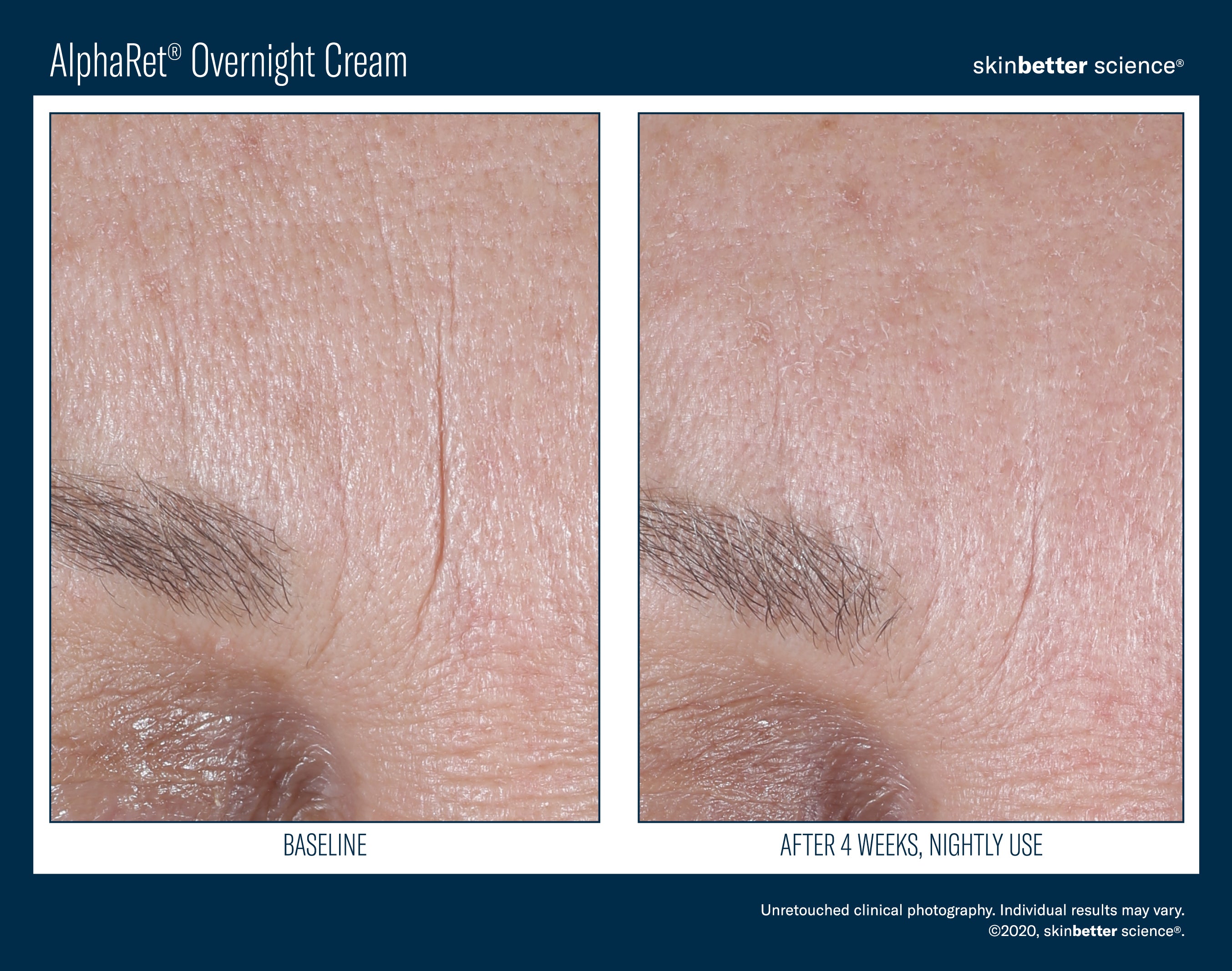 SkinBetter Science Trial Size AlphaRet Overnight Cream (0.17 oz)