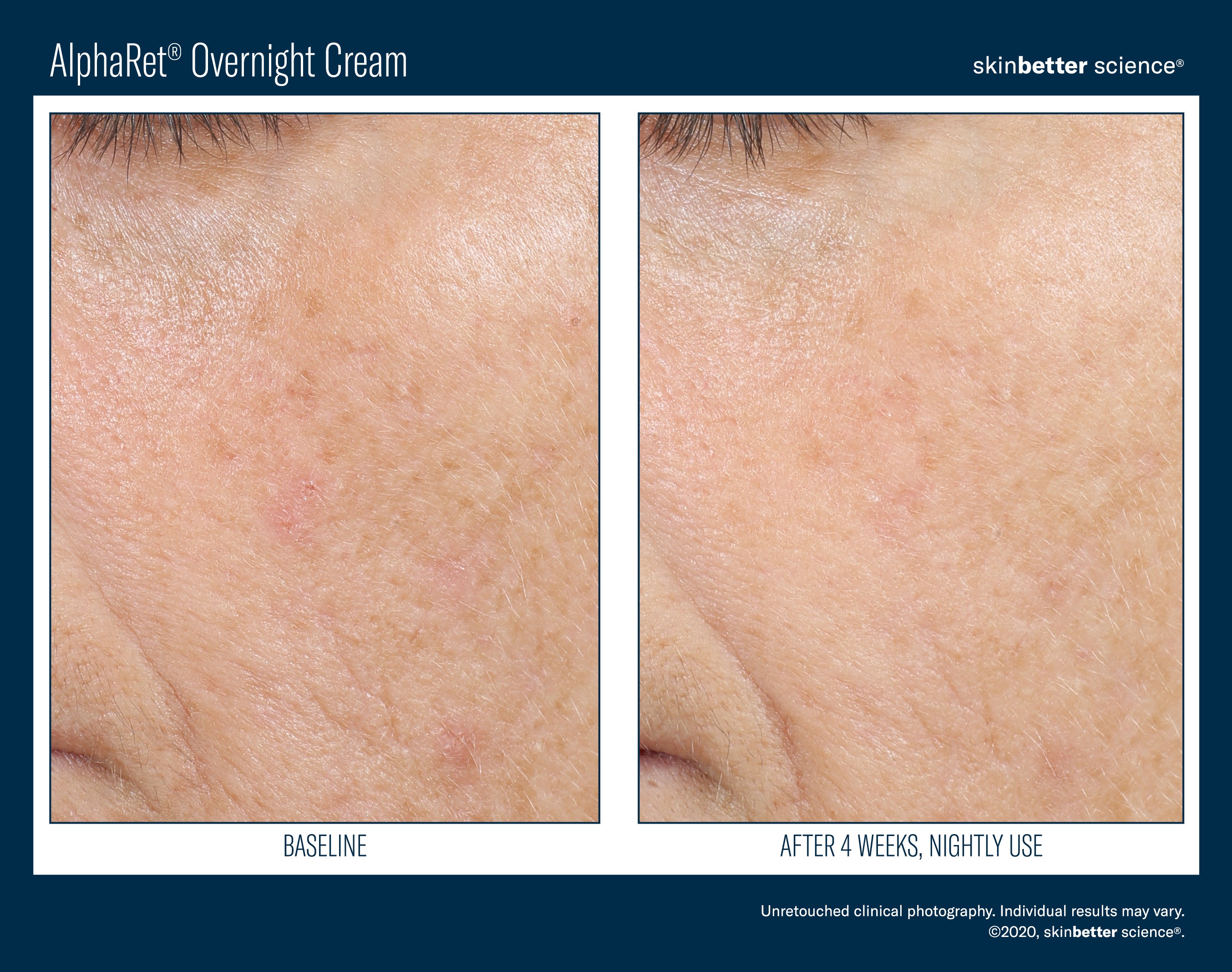 SkinBetter Science Trial Size AlphaRet Overnight Cream (0.17 oz)