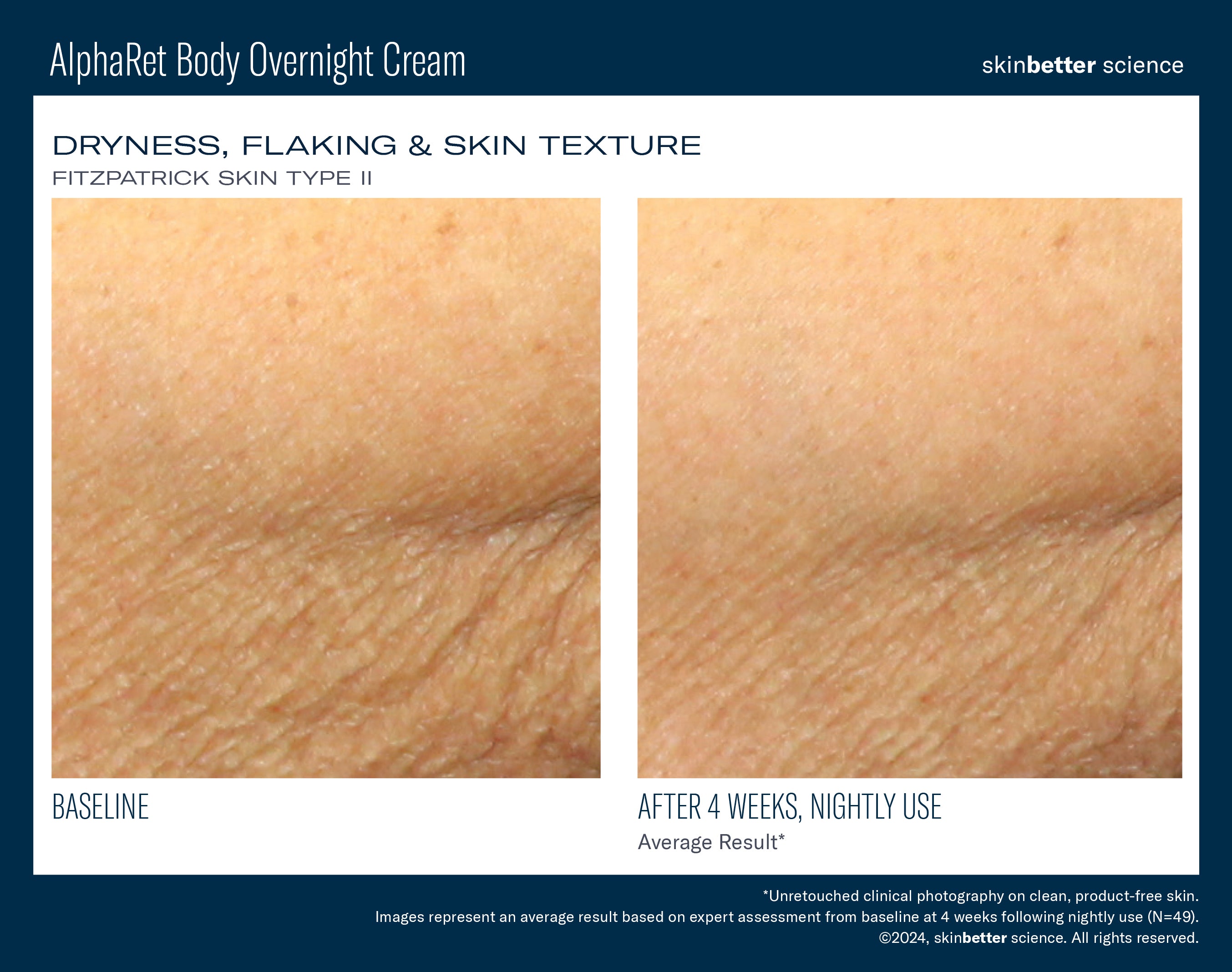 SkinBetter Science Travel Size AlphaRet Body Overnight Cream (0.5 oz)