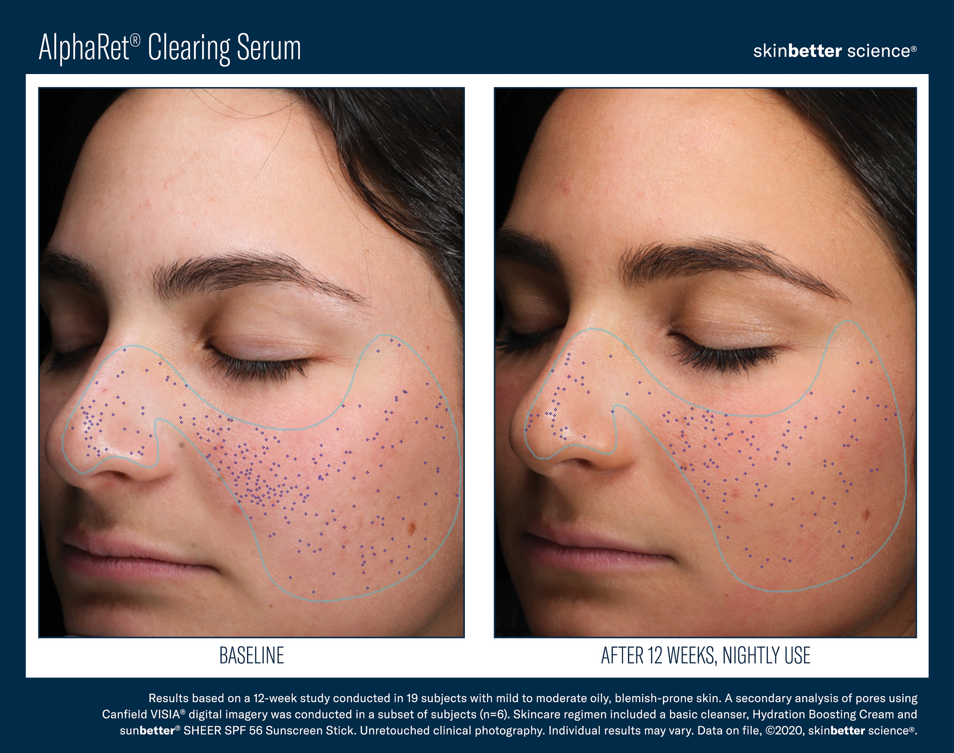 SkinBetter Science Travel Size AlphaRet Clearing Serum (0.17 oz)