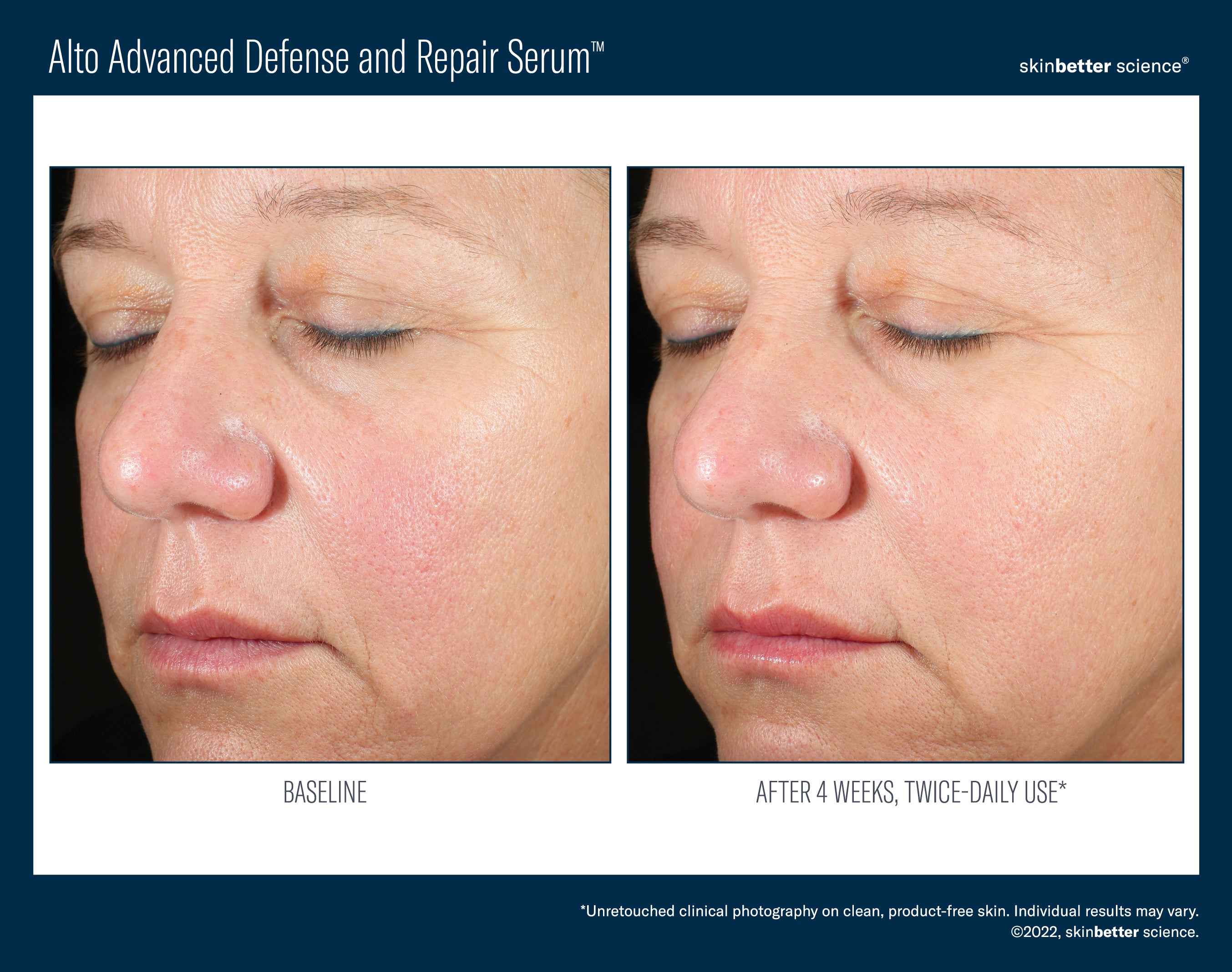 SkinBetter Science Travel Size Alto Advanced Defense and Repair Serum (0.5 oz)