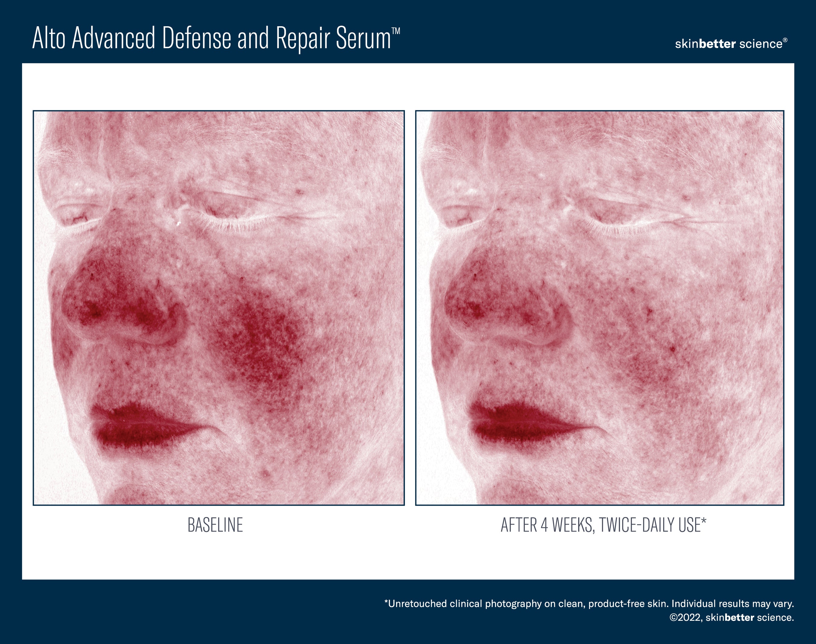 SkinBetter Science Alto Advanced Defense and Repair Serum (1 oz)