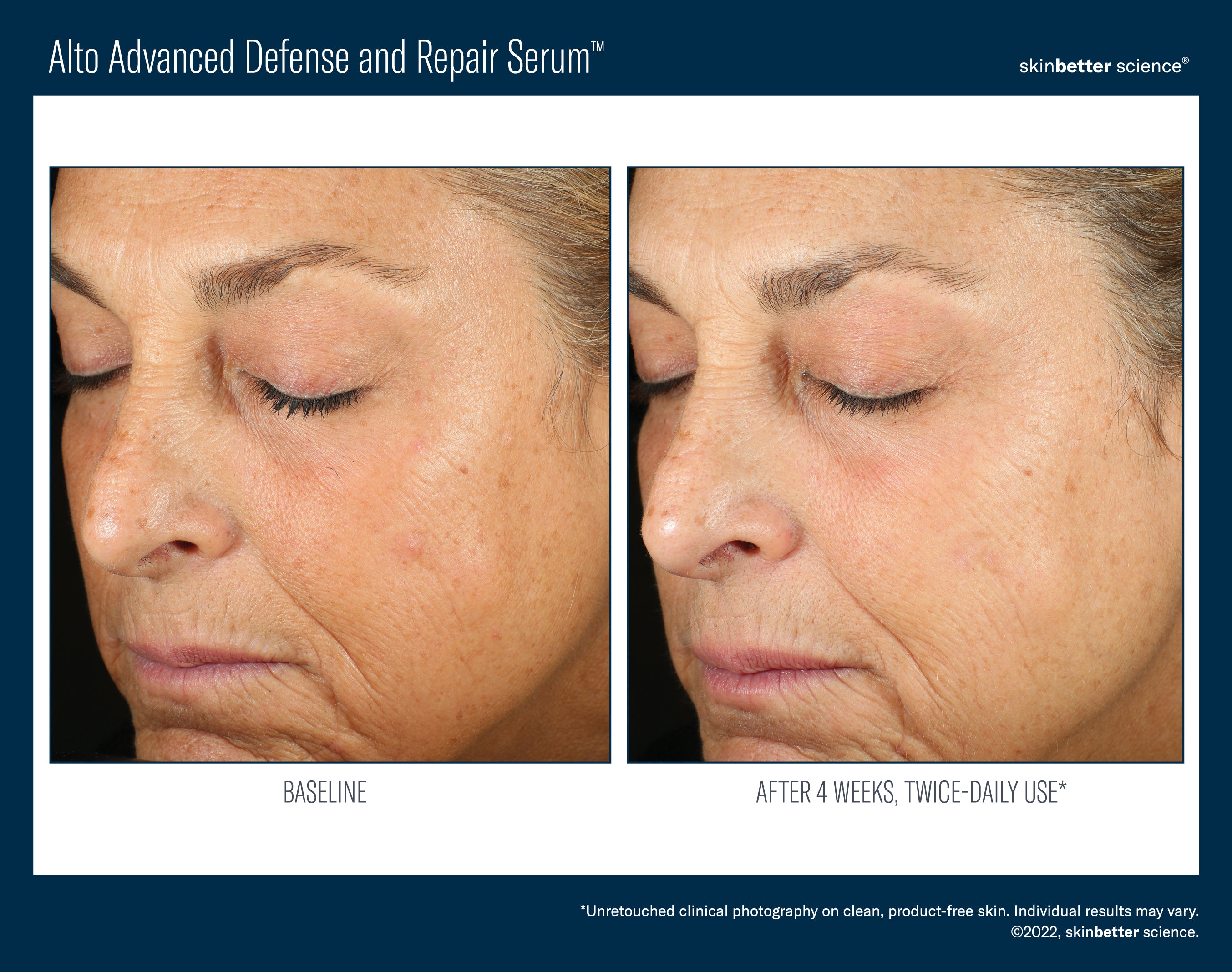 SkinBetter Science Travel Size Alto Advanced Defense and Repair Serum (0.5 oz)