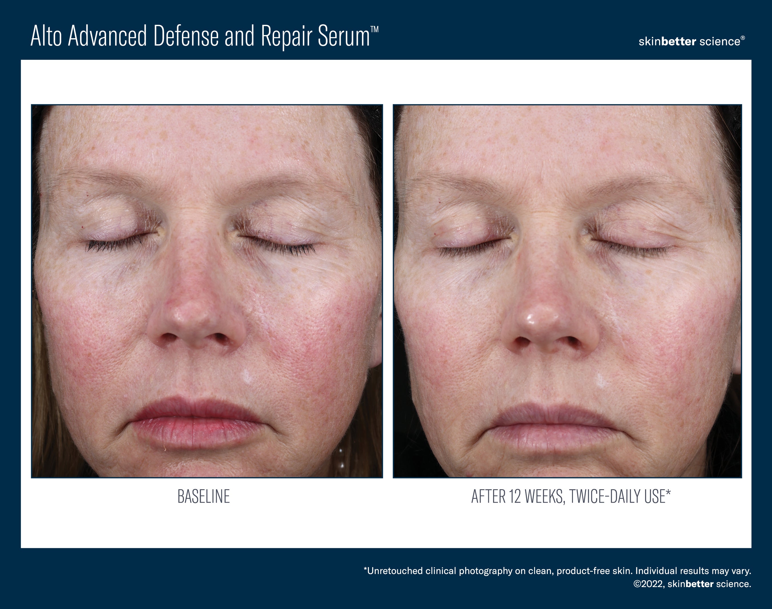 SkinBetter Science Travel Size Alto Advanced Defense and Repair Serum (0.5 oz)