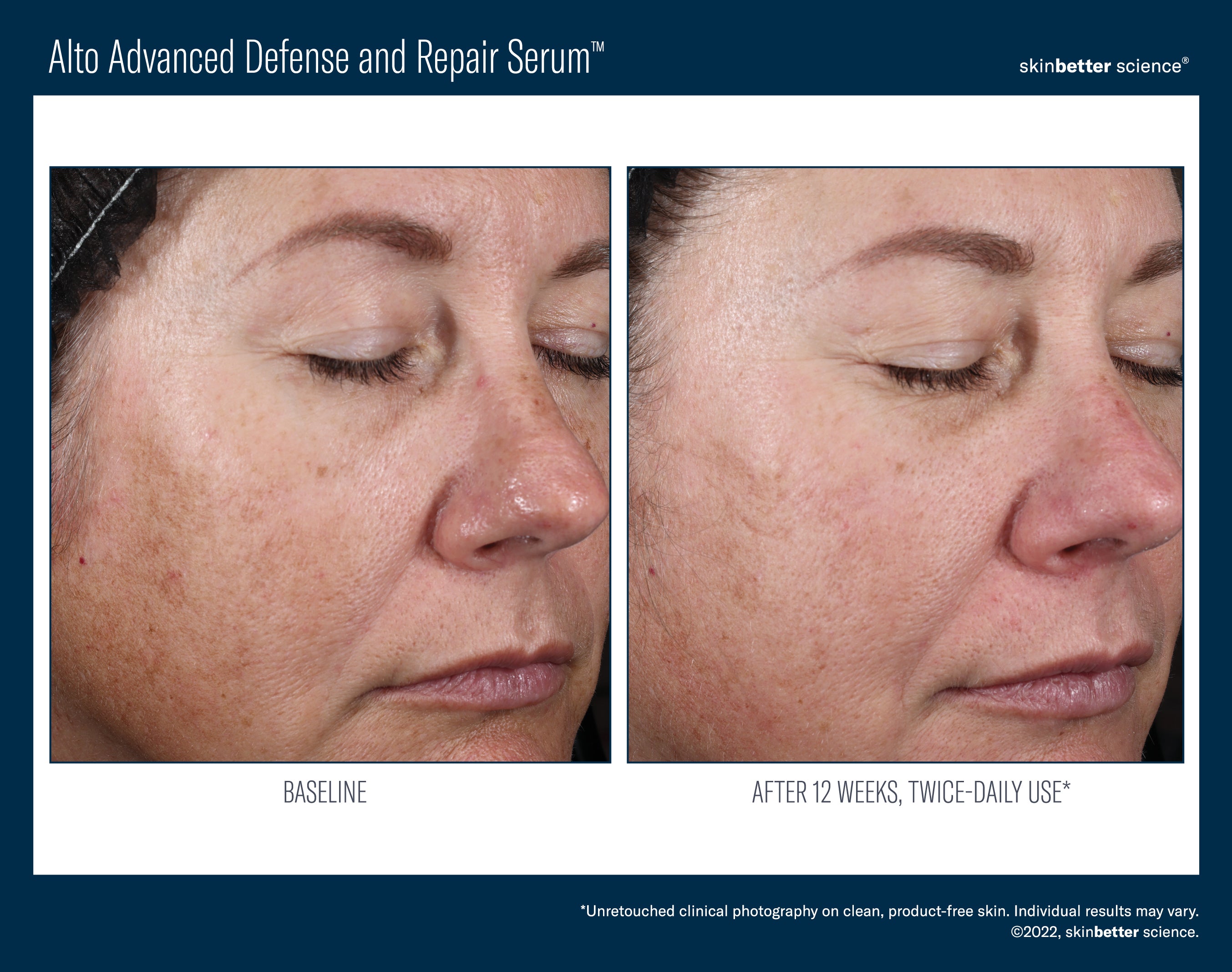 SkinBetter Science Alto Advanced Defense and Repair Serum (1 oz)