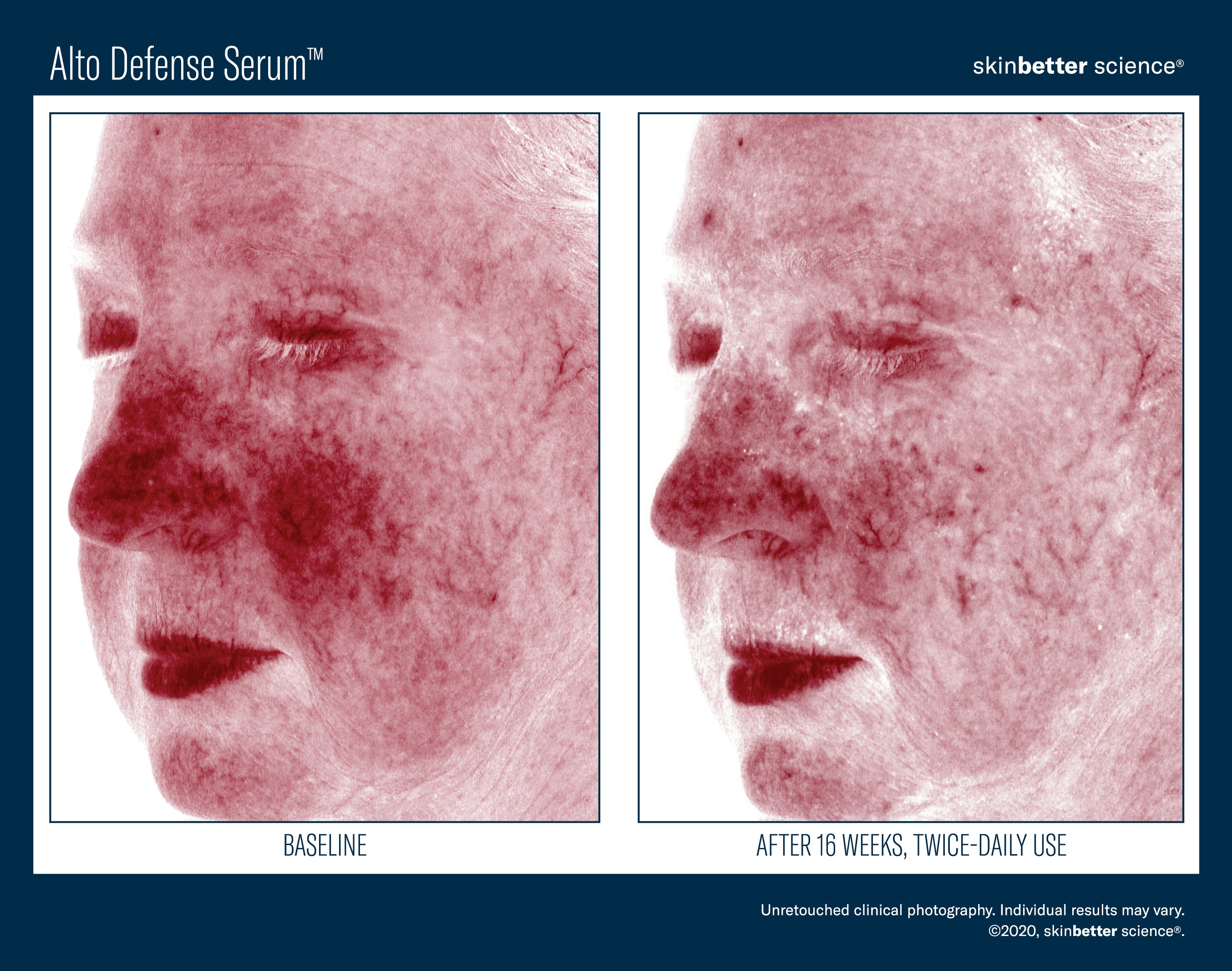 SkinBetter Science Alto Defense Serum (1 oz)