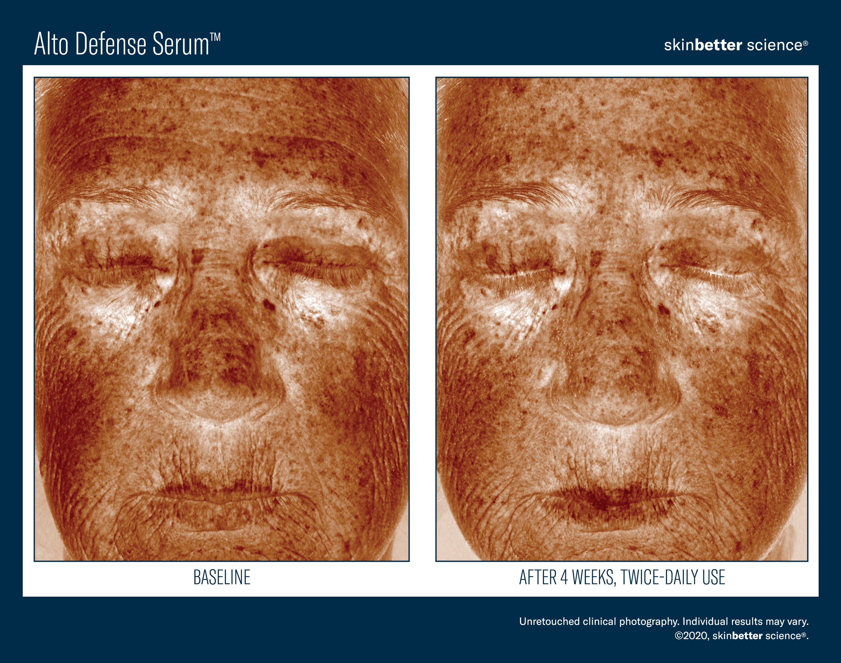 SkinBetter Science Alto Defense Serum (1 oz)