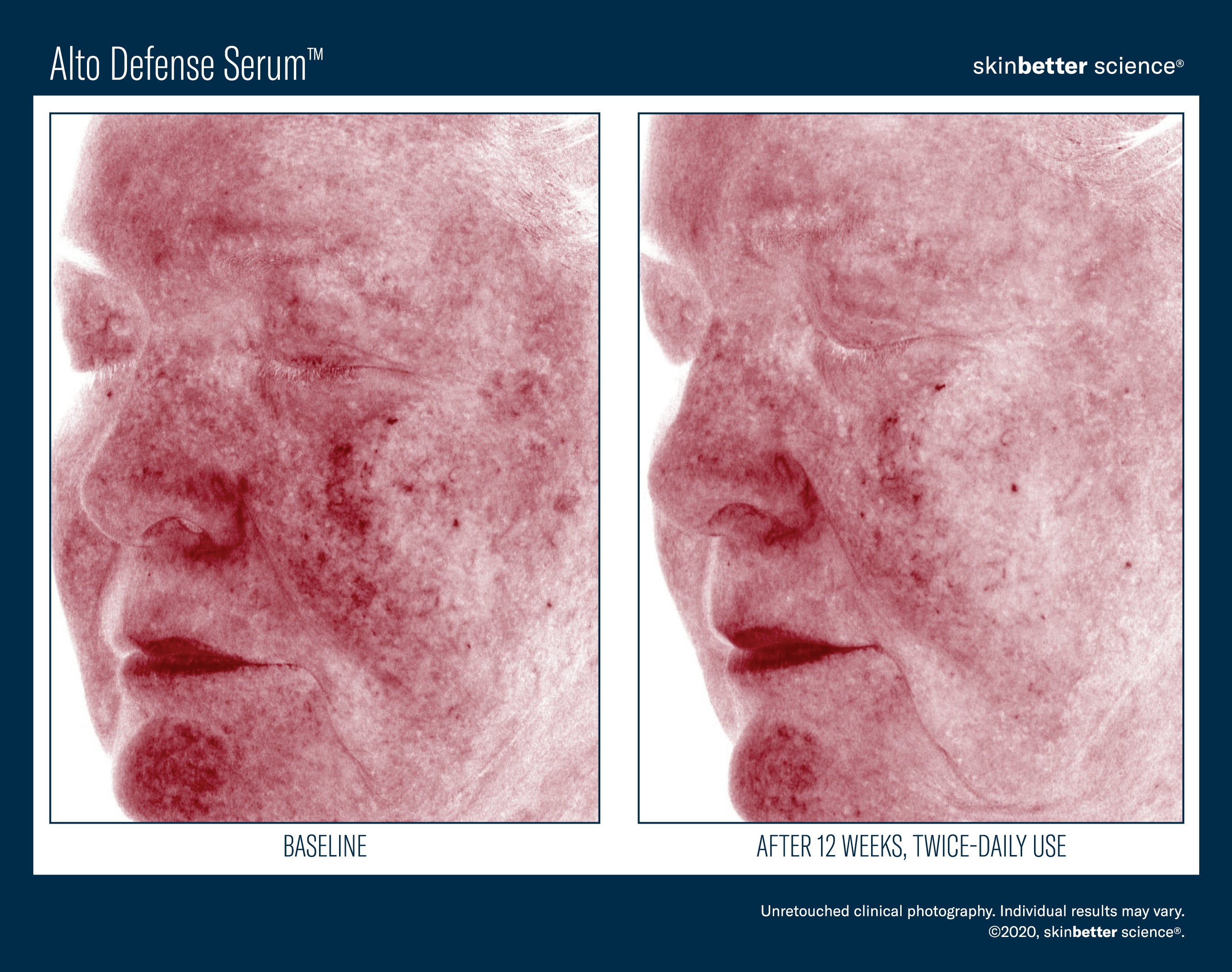 SkinBetter Science Alto Defense Serum (1.69 oz)