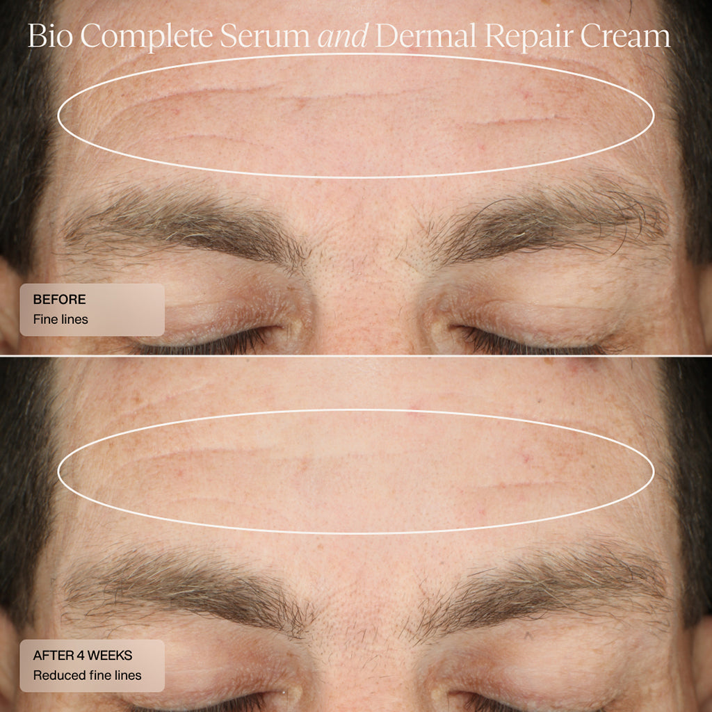 مصل Senté Bio Complete Serum (1 أونصة)