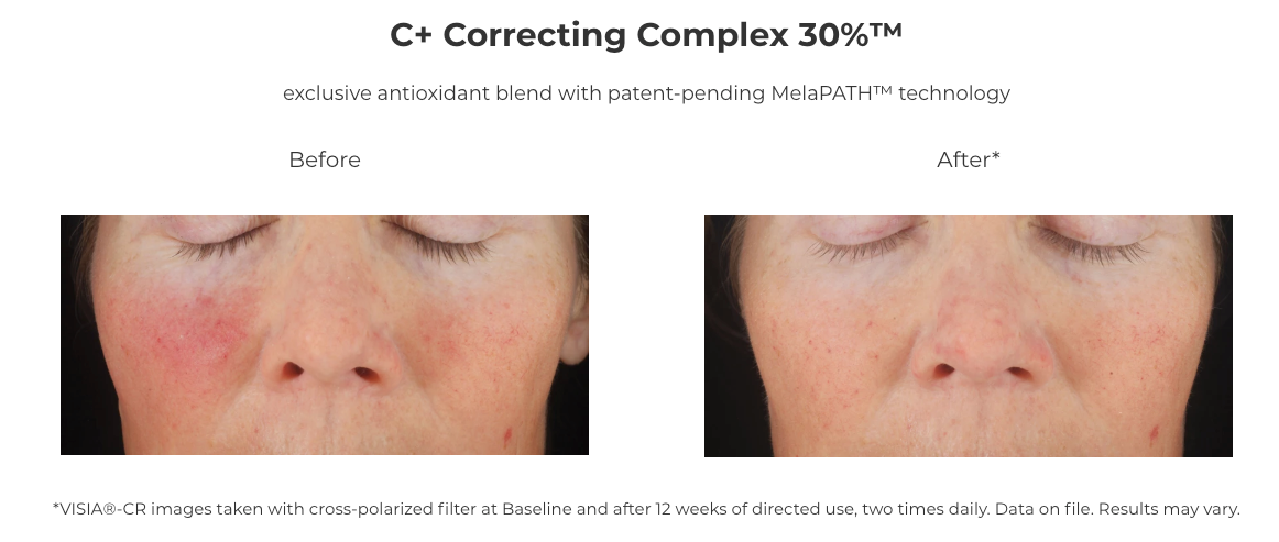 Reviżjoni Skincare C+ Correcting Complex 30%® (1 oz)
