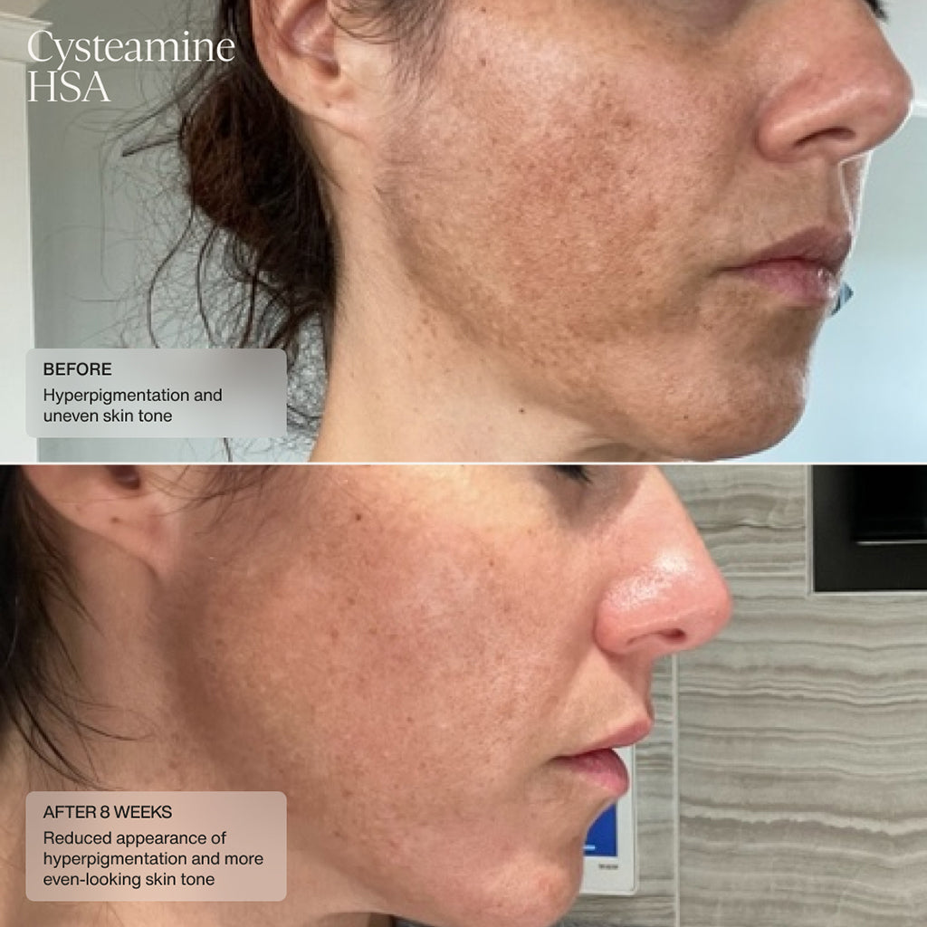 Senté Cysteamine HSA Pigment & Tone Corrector (1.69 oz) & Serum Bio Complete Serum (0.33 oz) Duo