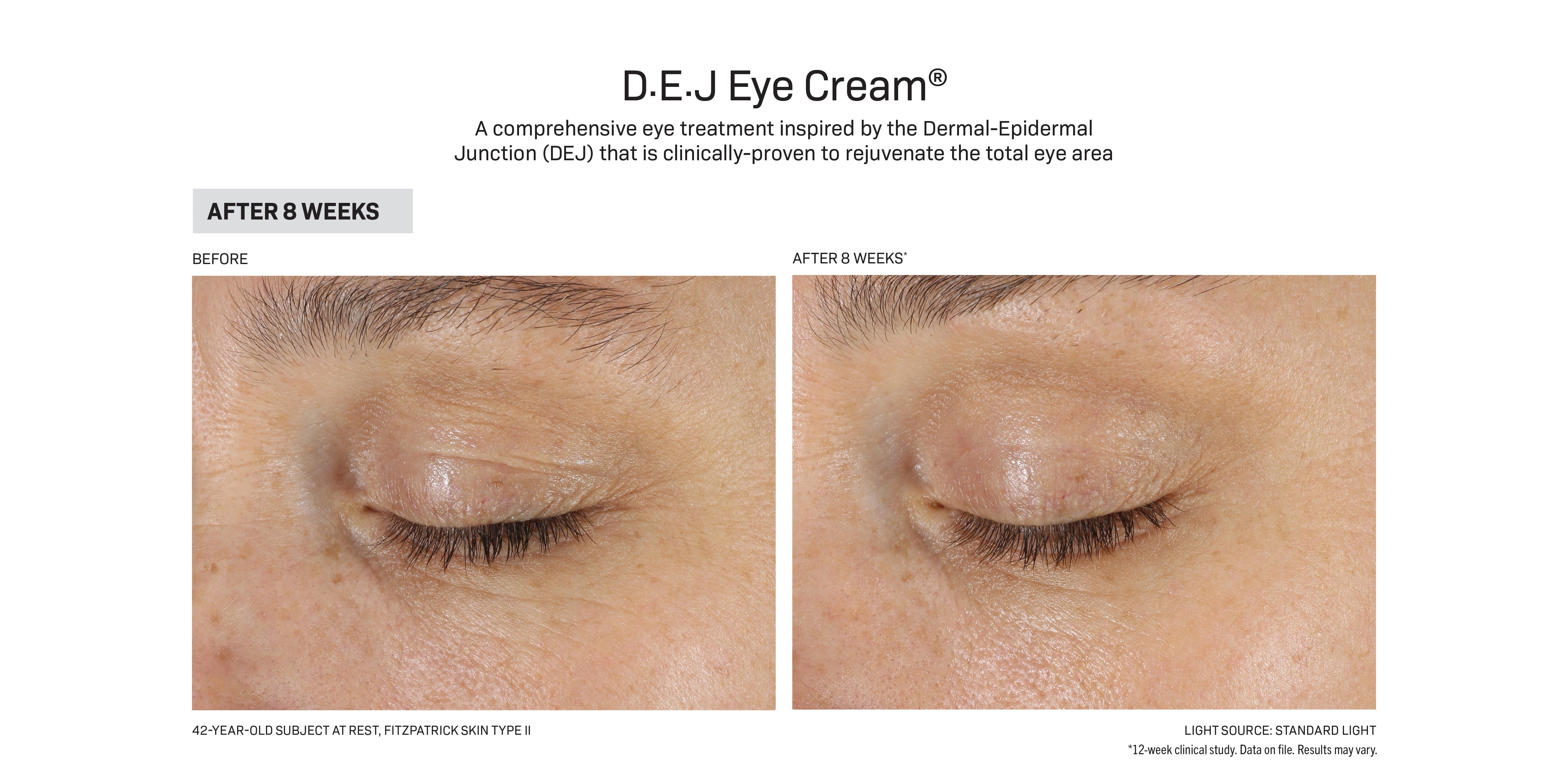 रिभिजन स्किनकेयर D·E·J Eye Cream® (०.५ औंस)