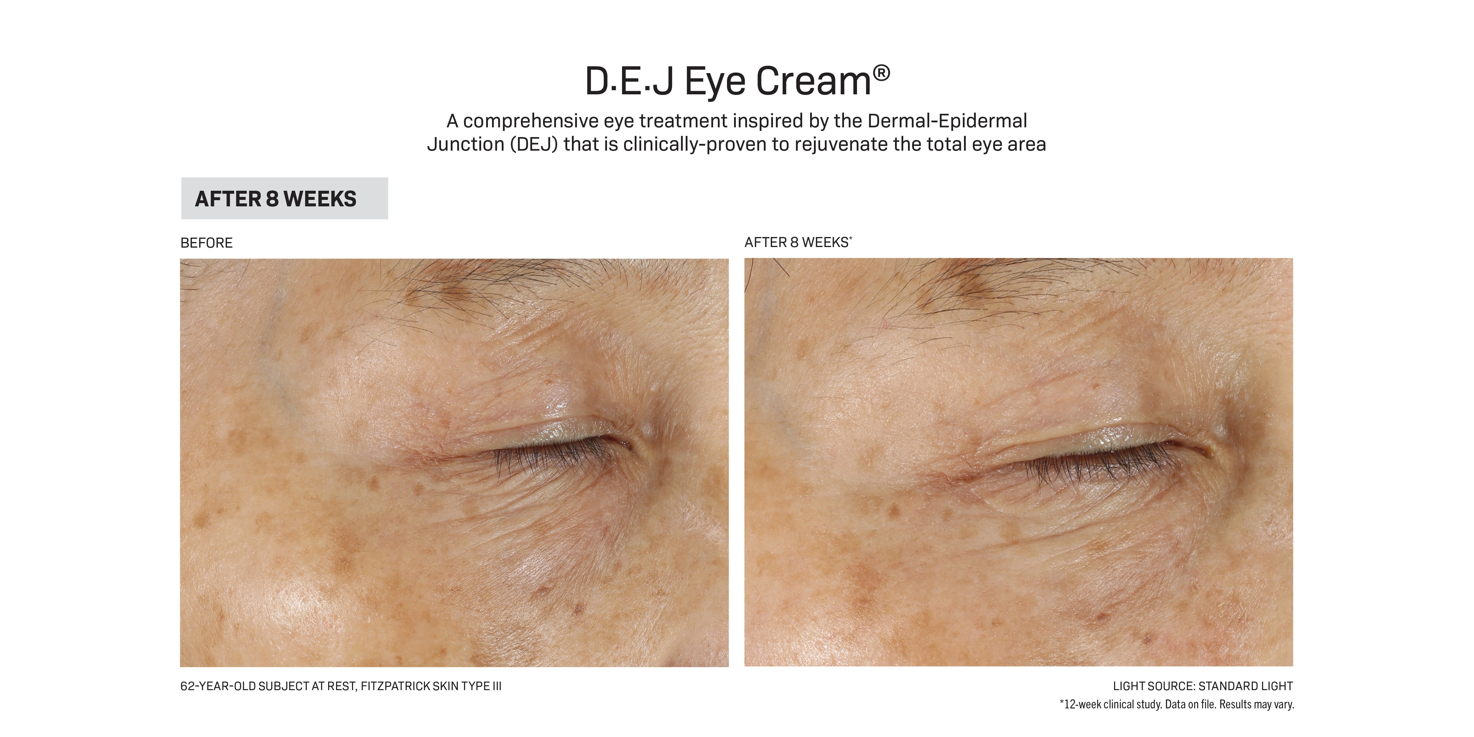 रिभिजन स्किनकेयर D·E·J Eye Cream® (०.५ औंस)