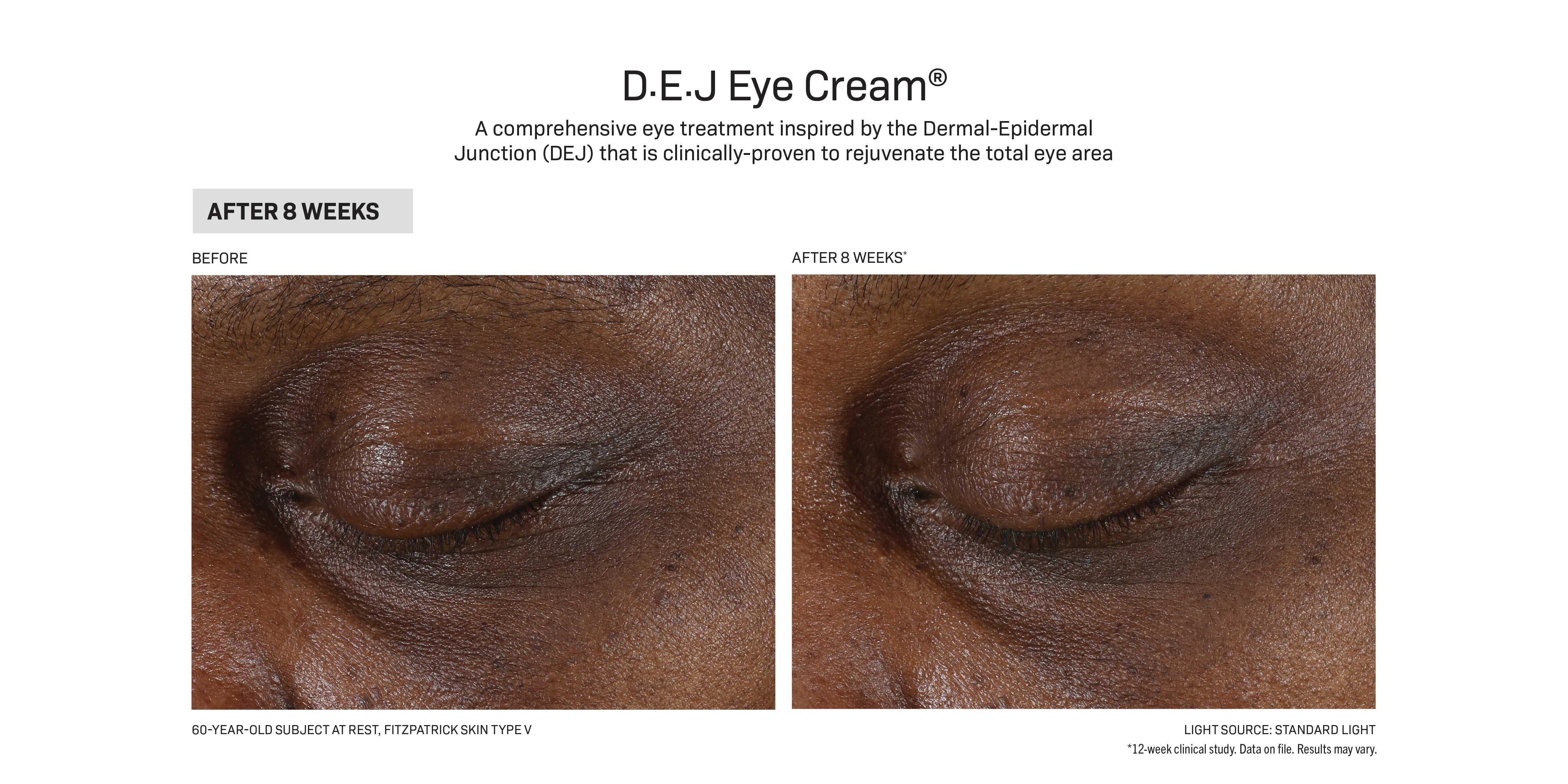 रिभिजन स्किनकेयर D·E·J Eye Cream® (०.५ औंस)