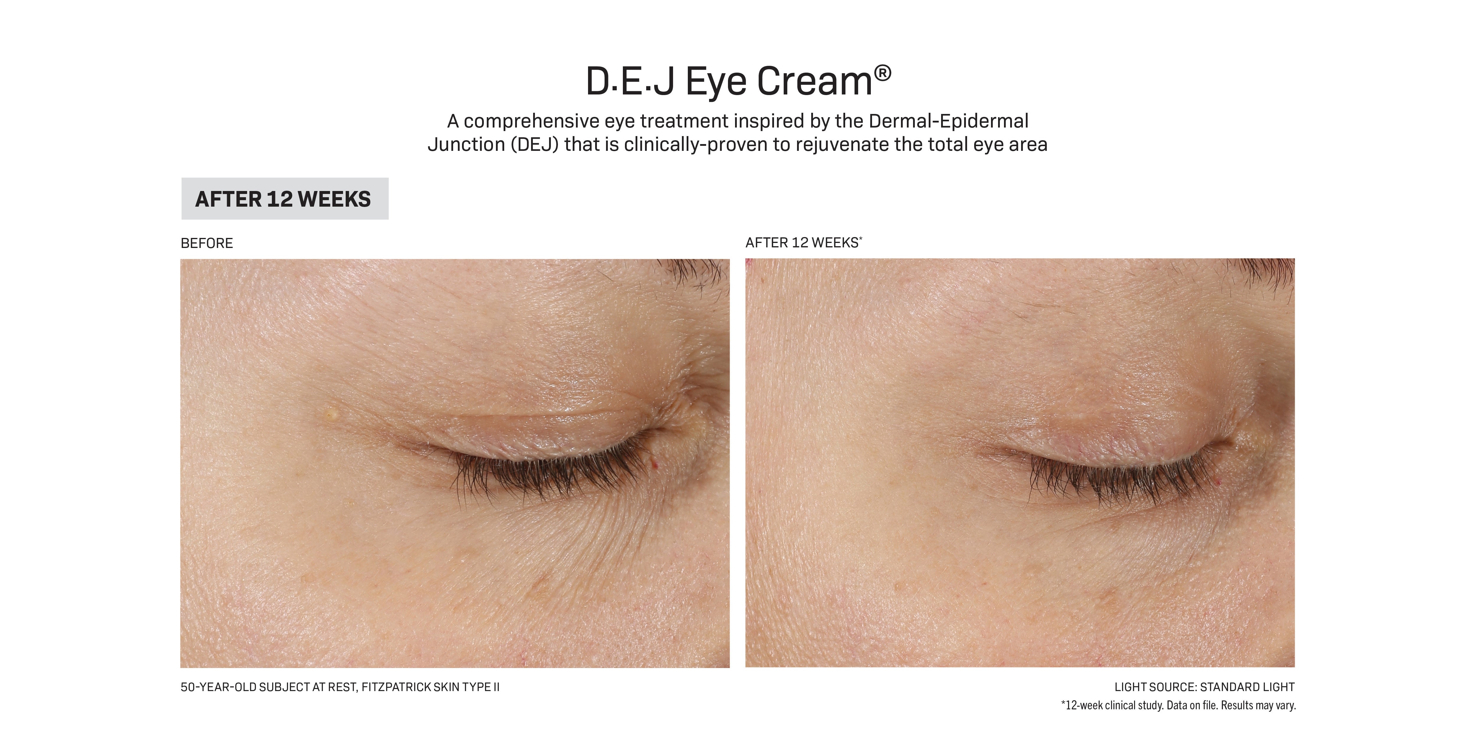 रिभिजन स्किनकेयर D·E·J Eye Cream® (०.५ औंस)