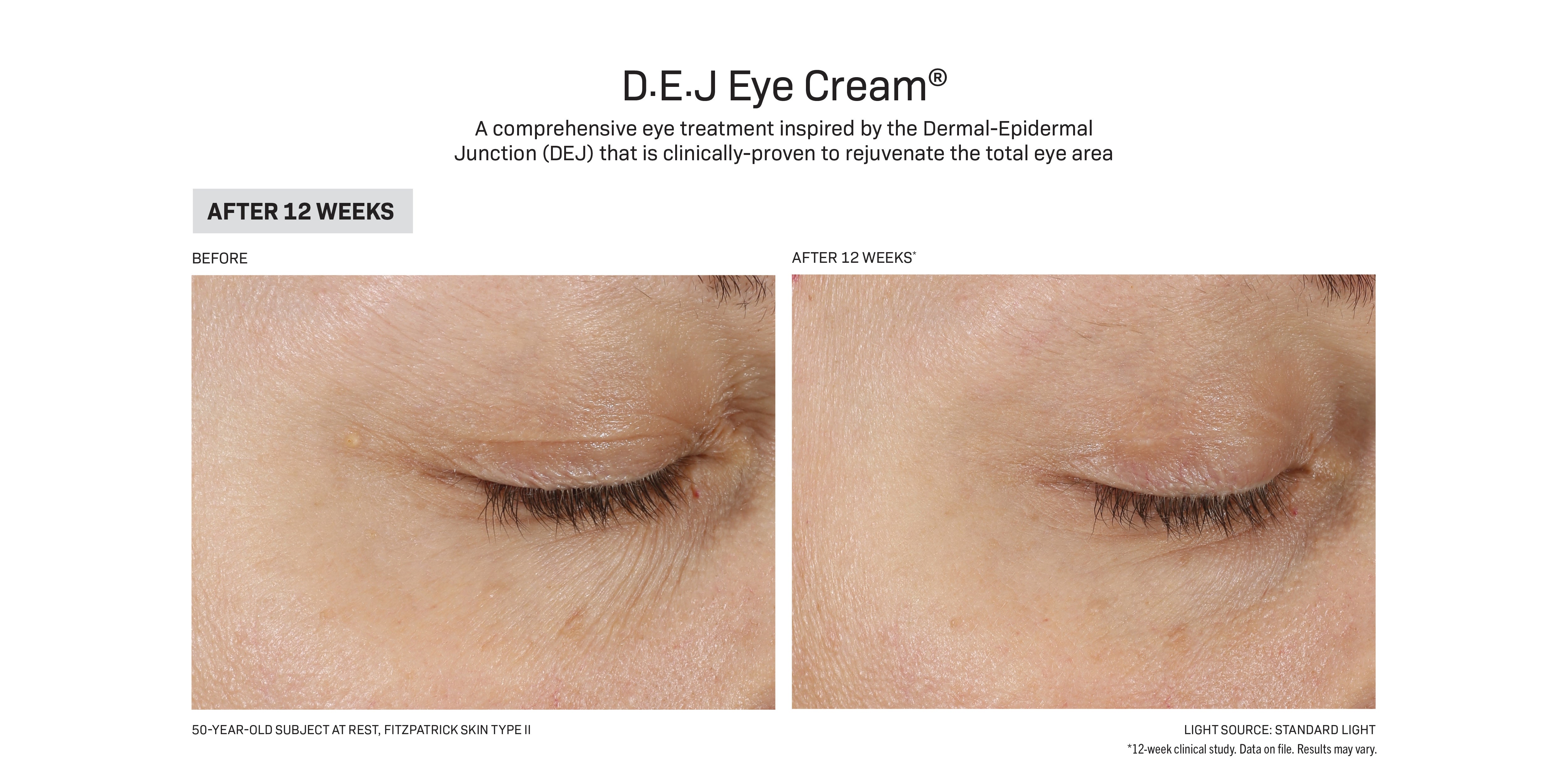 Revision Skincare D·E·J Eye Cream® (0.5 oz)