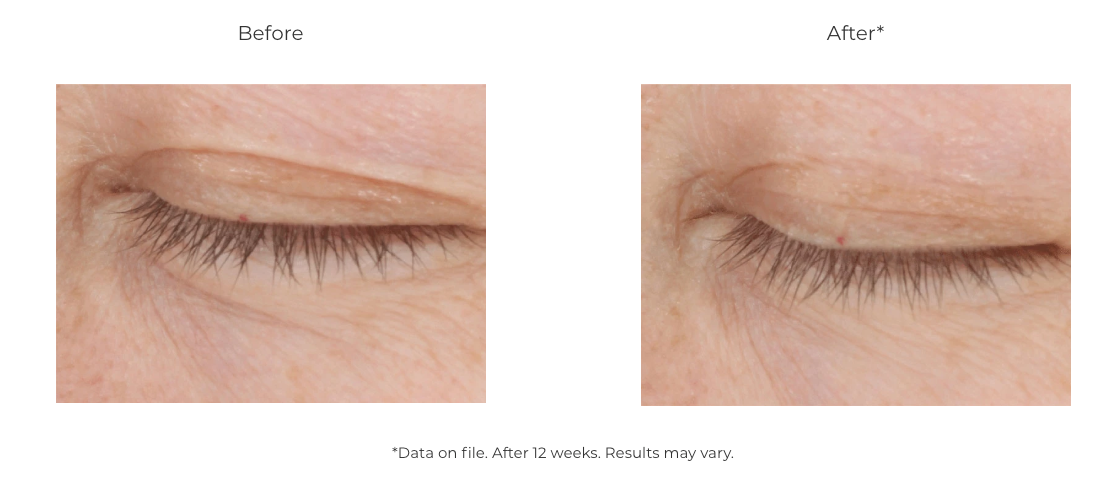 Revision Skincare D·E·J Eye Cream® (0.5 oz pumpe)