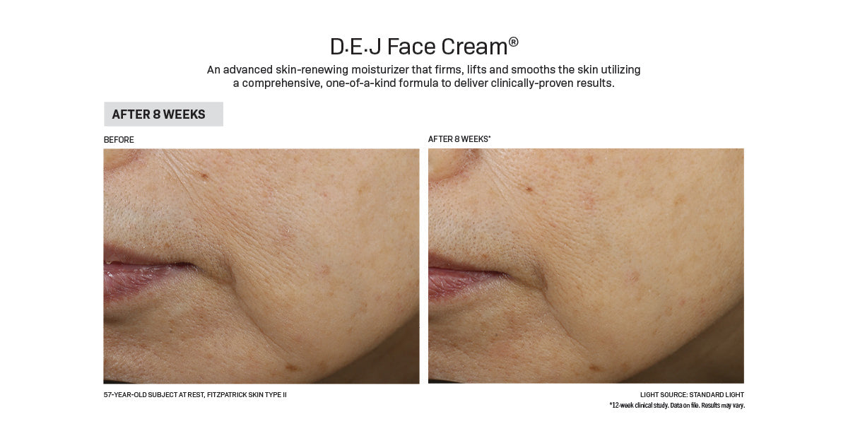 Revision Skincare D·E·J Face Cream® (1.7 ອໍ)