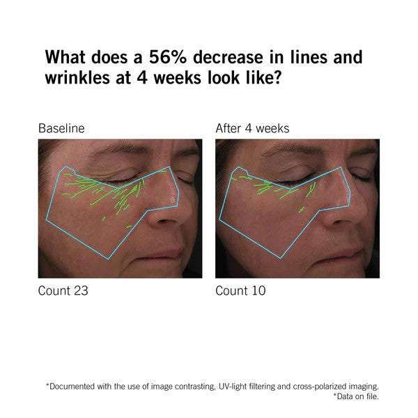 NEOVA SmartSkincare DNA Total Repair Correcting Serum (1 oz)