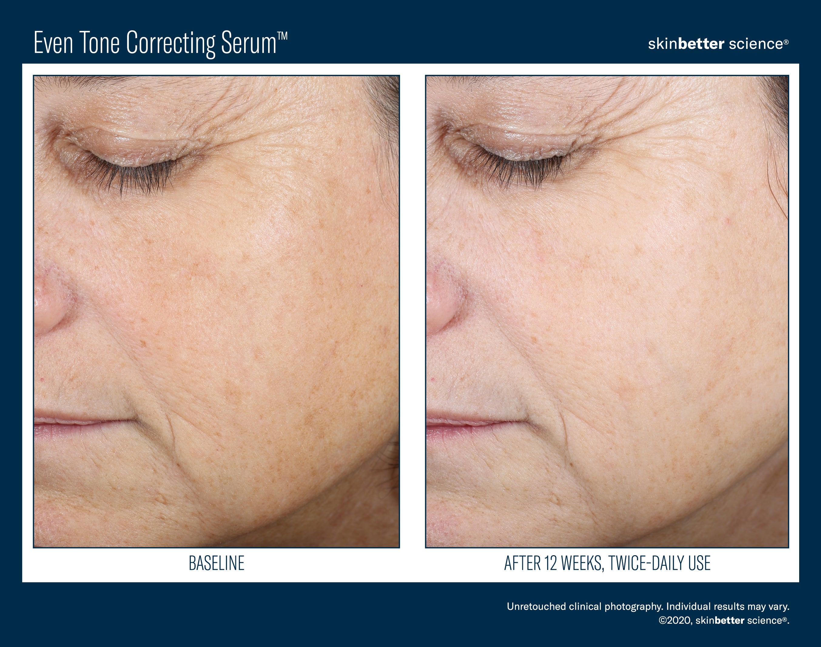 SkinBetter Science Even Tone Correcting Serum (1.69 oz)